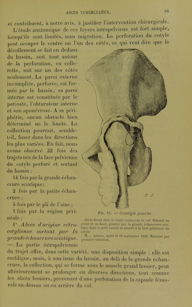 et contribuent, à noire avis, à justifier l'intervention chirurgicale. L'étude anatonn'que de ces foyers intrapelviens est fort simple, lorsqu'ils sont limités, sans migration. La perforation du cotyle peut occuper le centre ou l'un des côtés, ce qui veut dire que le décollement se fait en dedans du bassin, soit tout autour de la perforation, en colle- rette, soit sur un des côtés seulement. La paroi externe incomplète, perforée, est for- mée par le bassin ; sa paroi interne est constituée par le périoste, l'obturateur interne et son aponévrose. A sa péri- phérie, aucun obstacle bien déterminé ne le limite. La collection pourrait, semble- t-il, fuser dans les directions les plus variées. En fait, nous avons observé 22 fois des trajets nés de la face pelvienne du cotyle perforé et sortant du bassin : 14 fois par la grande échan- crure sciatique; 2 fois par la petite échan- crure ; 4 fois par le pli de l'aine ; 1 fois par la région péri- néale ; 1° Abcès d'origine rétro- cotyliennc sortant par la grande échancrure sciatique. — La partie intrapelvicnne du trajet offre, dans cette variété, une disposition simple : elle est rectiligne, mais, à son issue du bassin, au delà de la grande échan- crure, la collection, qui se forme sous le muscle grand fessier, peut irltérieurement se prolonger en diverses directions, tout comme les abcès fessiers, provenant d'une perforation de la capsule fémo- rale au-dessus ou en arrière du col. FiG. Gl. — Coxalgie gauche. Abcès fermé dont le trajet contourne le col fémoral en avant et en haut, pénètre par la grande échancrure scia- tique dans le petit bassin et aboutit à la face pelvienne du cotyle M..., garçon, opéré le 19 septembre 1896. Réunion par première intention.