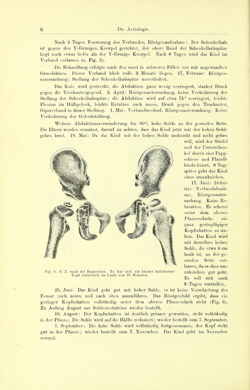 Nach 3 Tagen Fensterung des Verbandes, Röntgenaufnahme: Der Schenkelhals ist gegen den Y-förmigen Knorpel gerichtet, der obere Rand der Schenkelhalsspitze liegt noch etwas tiefer als der Y-förmige Knorpel. Nach 8 Tagen wird das Kind im Verband entlassen (s. Fig. 5). Die Behandlung erfolgte nach den sonst in schweren Fällen von mir angewandten Grundsätzen. Dieser Verband blieb volle 3 Monate liegen. 17. Februar: Röntgen- untersuchung : Stellung der Schenkelhalsspitze unverändert. Das Knie wird gestreckt, die Abduktion ganz wenig verringert, starker Druck gegen die Trochantergegend. 2. April: Röntgenuntersuchung, keine Veränderung der Stellung der Schenkelhalsspitze; die Abduktion wird auf etwa 750 verringert, leichte Flexion im Hüftgelenk, leichte Rotation nach innen, Druck gegen den Trochanter, Gipsverband in dieser Stellung. 1. Mai: Verbandwechsel, Röntgenuntersuchung. Keine Veränderung der Gelenkstellung. Weitere Abduktionsverminderung bis tS0°, hohe Sohle an der gesunden Seite. Die Eltern werden ermahnt, darauf zu achten, dass das Kind jetzt mit der hohen Sohle gehen lernt. 19. Mai: Da das Kind mit der hohen Sohle umknickt und nicht gehen will, wird der Stiefel und der Unterschen- kel durch eine Papj>- schiene und Flanell- binde fixiert. 8 Tage später geht das Kind ohne umzuknicken. 17. Juni: Defini- tive Verbandabnah- me , Röntgenunter- suchung. Keine Re- luxation. Es scheint unter dem oberen Pfannendache ein ganz geringfügiger Kopfschatten zu ste- hen. Das Kind wird mit derselben hohen Sohle, die etwa 6 cm hoch ist, an der ge- sunden Seite ent- lassen, da es ohne um- Fig. 6. E. Z. nach der Reposition. Es hat sich ein kleiner knöcherner zuknicken gut geht. Kopf entwickelt im Laufe von 10 Monaten. . Es soll sich nach 8 Tagen vorstellen. 25. Juni: Das Kind geht gut mit hoher Sohle, es ist keine Verschiebung des Femur nach unten und nach oben auszuführen. Das Röntgenbild ergibt, dass ein geringer Kopfschatten vollständig unter dem oberen Pfannendach steht (Fig. 6). Zu Anfang August zur Sohlenreduktion wieder bestellt. 10. August: Der Kopfschatten ist deutlich grösser geworden, steht vollständig in der Pfanne. Die Sohle wird auf die Hälfte reduziert; wieder bestellt zum 7. September. 7. September: Die hohe Sohle wird vollständig fortgenommen, der Kopf steht gut in der Pfanne; wieder bestellt zum 7. November. Das Kind geht im November normal.