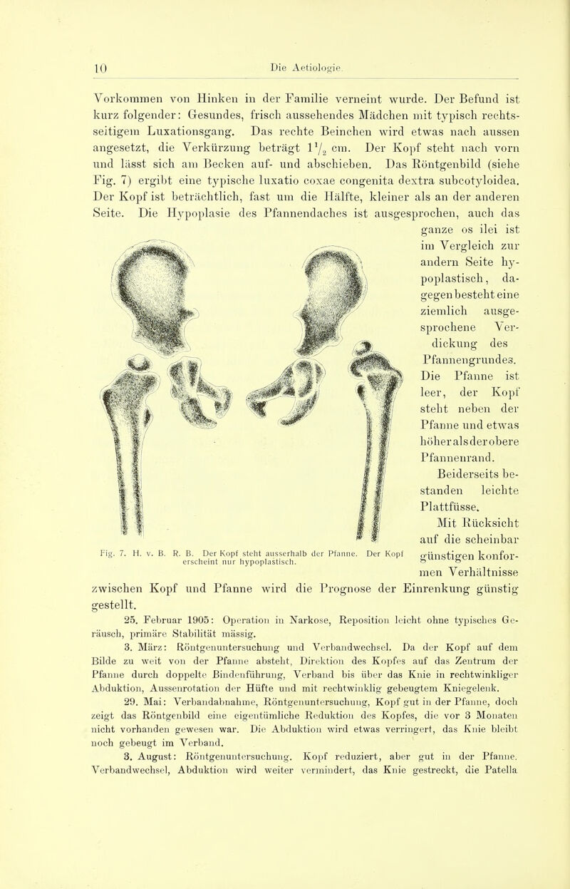 Vorkommen von Hinken in der Familie verneint wurde. Der Befund ist kurz folgender: Gesundes, frisch aussehendes Mädchen mit typisch rechts- seitigem Luxationsgang. Das rechte Beinchen wird etwas nach aussen angesetzt, die Verkürzung beträgt l1/., cm. Der Kopf steht nach vorn und lässt sich am Becken auf- und abschieben. Das Röntgenbild (siehe Fig. 7) ergibt eine typische luxatio coxae congenita dextra subcotyloidea. Der Kopf ist beträchtlich, fast um die Hälfte, kleiner als an der anderen Seite. Die Hypoplasie des Pfannendaches ist ausgesprochen, auch das ganze os ilei ist im Vergleich zur andern Seite hy- poplastisch , da- gegen besteht eine ziemlich ausge- sprochene Ver- dickung des Pfannengrundes. Die Pfanne ist leer, der Kopf steht neben der Pfanne und etwas höher al s der obere Pfannenrand. Beiderseits be- standen leichte Plattfüsse» Mit Rücksicht auf die scheinbar günstigen konfor- men Verhältnisse zwischen Kopf und Pfanne wird die Prognose der Einrenkung günstig gestellt. 25. Februar 1905: Operation in Narkose, Reposition leicht ohne tyjjisches Ge- räusch, primäre Stabilität mässig. 3. März: Röntgenuntersuchung und Verbandwechsel. Da der Kopf auf dem Bilde zu weit von der Pfanne absteht, Direktion des Kopfes auf das Zentrum der Pfanne durch doppelte Bindenführung, Verband bis über das Knie in rechtwinkliger Abduktion, Aussenrotation der Hüfte und mit rechtwinklig gebeugtem Kniegelenk. 29. Mai: Verbandabnahme, Röntgenuntersuchung, Kopf gut in der Pfanne, doch zeigt das Röntgenbild eine eigentümliche Reduktion des Kopfes, die vor 3 Monaten nicht vorhanden gewesen war. Die Abduktion wird etwas verringert, das Knie bleibt noch gebeugt im Verband. 3. August: Röntgenuntersuchung. Kopf reduziert, aber gut in der Pfanne. Verbandwechsel, Abduktion wird weiter vermindert, das Knie gestreckt, die Patella Fig. 7. H. v. B. R. B. Der Kopf steht ausserhalb der Pfanne. Der Kopf erscheint nur hypoplastisch.