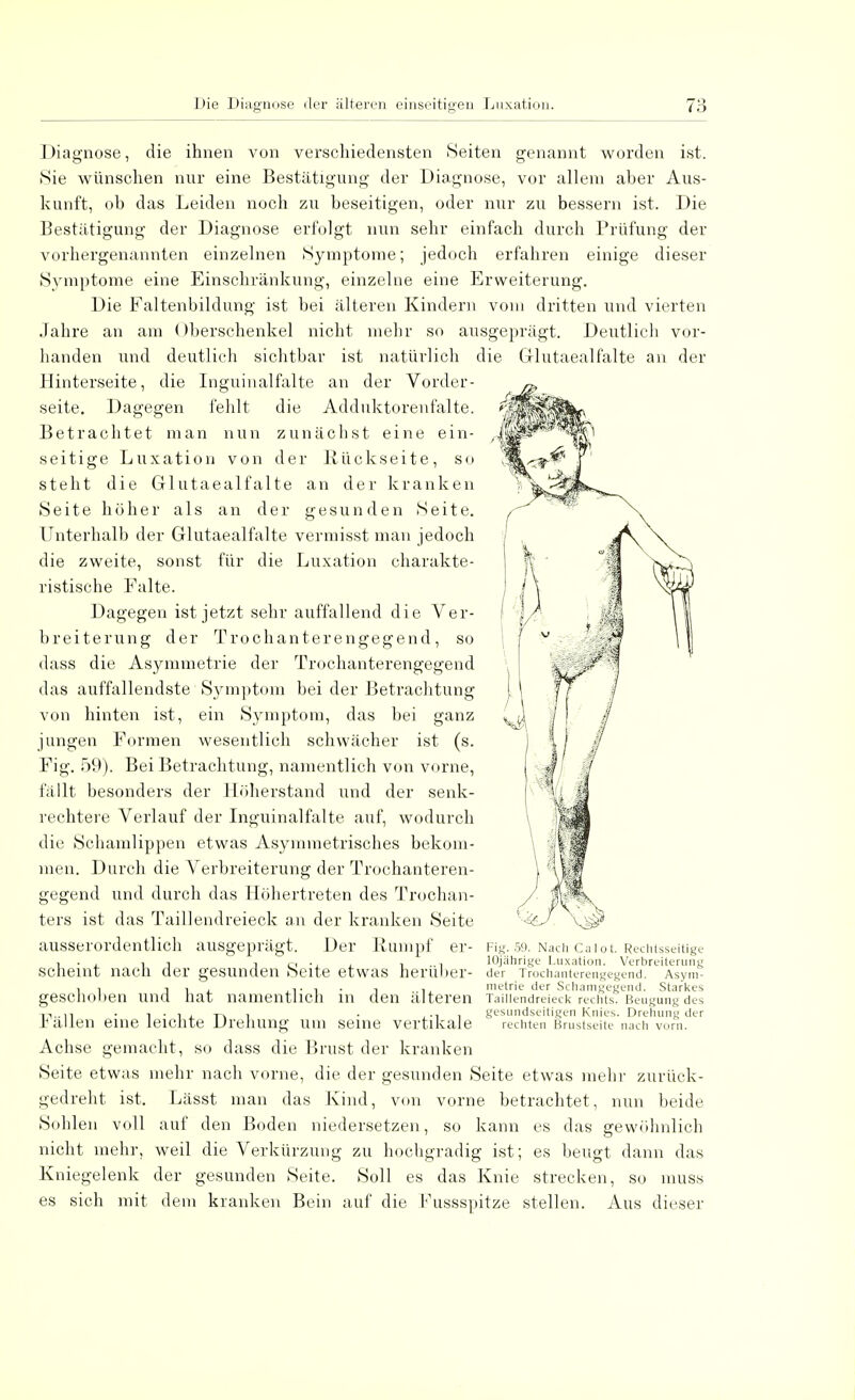 Diagnose, die ihnen von verschiedensten Seiten genannt worden ist. Sie wünschen nur eine Bestätigung der Diagnose, vor allem aber Aus- kunft, ob das Leiden noch zu beseitigen, oder nur zu bessern ist. Die Bestätigung der Diagnose erfolgt nun sehr einfach durch Prüfung der vorhergenannten einzelnen Symptome; jedoch erfahren einige dieser Symptome eine Einschränkung, einzelne eine Erweiterung. Die Faltenbildung ist bei älteren Kindern vom dritten und vierten Jahre an am ()berschenkel nicht mehr so ausgeprägt. Deutlich vor- handen und deutlich sichtbar ist natürlich die Grlutaealfalte an der Hinterseite, die Inguinalfalte an der Vorder- seite. Dagegen fehlt die Adduktorenfalte. Betrachtet man nun zunächst eine ein- seitige Luxation von der Bückseite, so steht die Glutaealfalte an der kranken Seite höher als an der gesunden Seite. Unterhalb der Glutaealfalte vermisst man jedoch die zweite, sonst für die Luxation charakte- ristische Falte. Dagegen ist jetzt sehr auffallend die Ver- breiterung der Trochanterengegend, so dass die Asymmetrie der Trochanterengegend das auffallendste Symptom bei der Betrachtung von hinten ist, ein Symptom, das bei ganz jungen Formen wesentlich schwächer ist (s. Fig. 59). Bei Betrachtung, namentlich von vorne, fällt besonders der Höherstand und der senk- rechtere Verlauf der Inguinalfalte auf, wodurch die Schamlippen etwas Asymmetrisches bekom- men. Durch die Verbreiterung der Trochanteren- gegend und durch das Höhertreten des Trochan- ters ist das Taillendreieck an der kranken Seite ausserordentlich ausgeprägt. Der Rumpf er- Fig. 59. Nach Caiot. Rechtsseitige , . , , -i i o -i i ..l 10jährige Luxation. Verbreiterung Scheint nach der gesunden beite etwas herüber- der Trochanterengegend. Asym- , , j , .,. , . , metrie der Schamgegcnd. Starkes geschoben und hat namentlich in den alteren Taillendreieck rechts. Beugung des • i • l i. t\ i • gesundseitigen Knies. Drehung der lallen eine leichte Drehung um seine vertikale rechten Brustseite nach vom. Achse gemacht, so dass die Brust der kranken Seite etwas mehr nach vorne, die der gesunden Seite etwas mehr zurück- gedreht ist. Lässt man das Kind, von vorne betrachtet, nun beide Sohlen voll auf den Boden niedersetzen, so kann es das gewöhnlich nicht mehr, weil die Verkürzung zu hochgradig ist; es beugt dann das Kniegelenk der gesunden Seite. Soll es das Knie strecken, so muss es sich mit dem kranken Bein auf die Fussspitze stellen. Aus dieser