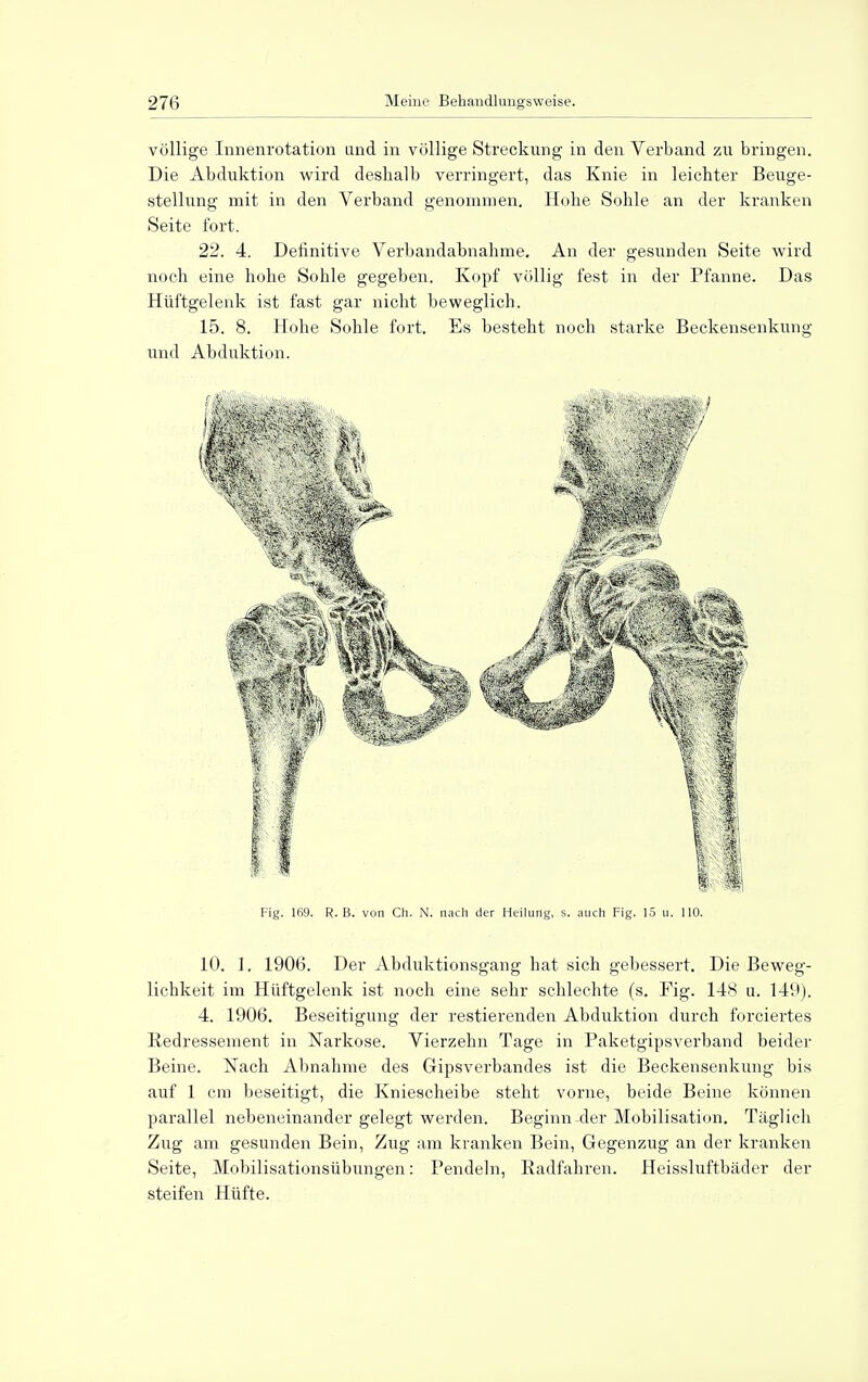 völlige Innenrotation and in völlige Streckung in den Verband zu bringen. Die Abduktion wird desbalb verringert, das Knie in leichter Beuge- stellung mit in den Verband genommen. Hobe Sohle an der kranken Seite fort. 22. 4. Definitive Verbandabnahme. An der gesunden Seite wird noch eine hohe Sohle gegeben. Kopf völlig fest in der Pfanne. Das Hüftgelenk ist fast gar nicht beweglich. 15. 8. Hohe Sohle fort. Es besteht noch starke Beckensenkung und Abduktion. Fig. 169. R.B. von Ch. N. nach der Heilung, s. auch Fig. 15 u. 110. 10. 1. 1906. Der Abduktionsgang hat sich gebessert. Die Beweg- lichkeit im Hüftgelenk ist noch eine sehr schlechte (s. Fig. 148 u. 149). 4. 1906. Beseitigung der restierenden Abduktion durch forciertes Redressement in Narkose. Vierzehn Tage in Paketgipsverband beider Beine. Nach Abnahme des Gipsverbandes ist die Beckensenkung bis auf 1 cm beseitigt, die Kniescheibe steht vorne, beide Beine können parallel nebeneinander gelegt werden. Beginn der Mobilisation. Täglich Zug am gesunden Bein, Zug am kranken Bein, Gegenzug an der kranken Seite, Mobilisationsübungen: Pendeln, Radfahren. Heissluftbäder der steifen Hüfte.