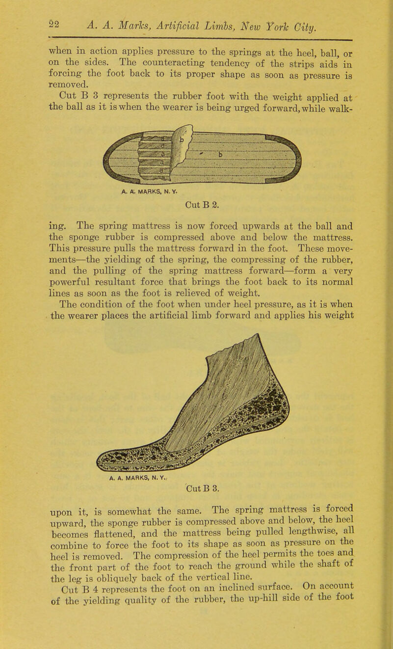 when in action applies pressure to the springs at the heel, ball, or on the sides. The counteracting tendency of the strips aids in forcing the foot back to its proper shape as soon as pressure is removed. Cut B 3 represents the rubber foot with the weight applied at the ball as it is when the wearer is being urged forward, while walk- A. A. MARKS. N. Y. Cut B 2. ing. The spring mattress is now forced upwards at the ball and the sponge rubber is compressed above and below the mattress. This pressure pulls the mattress forward in the foot. These move- ments—the yielding of the spring, the compressing of the rubber, and the pulling of the spring mattress forward—form a very powerful resultant force that brings the foot back to its normal lines as soon as the foot is relieved of weight. The condition of the foot when under heel pressure, as it is when the wearer places the artificial limb forward and applies his weight upon it, is somewhat the same. The spring mattress is forced upward, the sponge rubber is compressed above and below, the heel becomes flattened, and the mattress being pulled lengthwise, all combine to force the foot to its shape as soon as pressure on the heel is removed. The compression of the heel permits the toes and the front part of the foot to reach the ground while the shaft of the leg is obliquely back of the vertical line. Cut B 4 represents the foot on an inclined surface. On account of the yielding quality of the rubber, the up-hill side of the foot