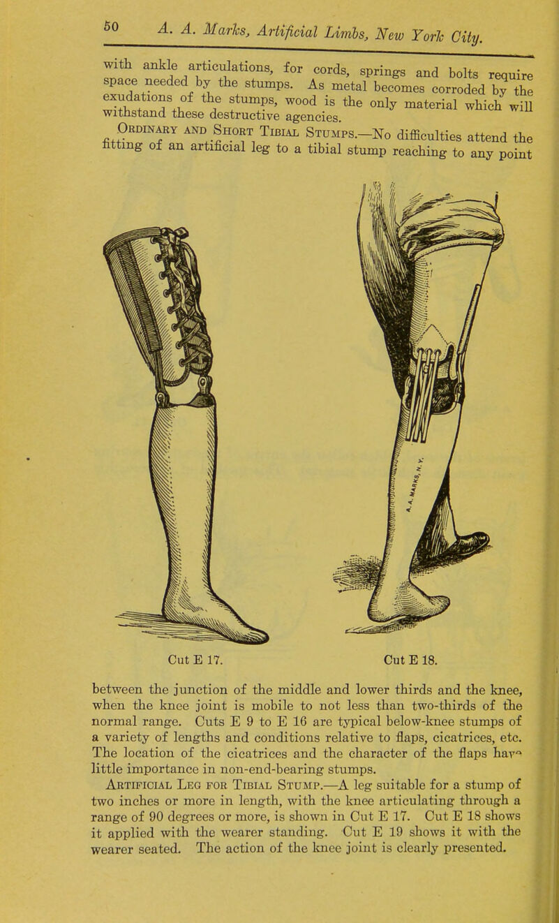 with ankle articulations, for cords, springs and bolts require space needed by the stumps. As metal becomes corroded bTthe exudations of the stumps, wood is the only material which will withstand these destructive agencies Ordinary and Short Tibial Stumps.-No difficulties attend the fitting of an artificial leg to a tibial stump reaching to any point Cut E 17. Cut E 18. between the junction of the middle and lower thirds and the knee, when the knee joint is mobile to not less than two-thirds of the normal range. Cuts E 9 to E 16 are typical below-knee stumps of a variety of lengths and conditions relative to flaps, cicatrices, etc. The location of the cicatrices and the character of the flaps hav1 little importance in non-end-bearing stumps. Artificial Leg for Tibial Stump.—A leg suitable for a stump of two inches or more in length, with the knee articulating through a range of 90 degrees or more, is shown in Cut E 17. Cut E 18 shows it applied with the wearer standing. Cut E 19 shows it with the wearer seated. The action of the knee joint is clearly presented.