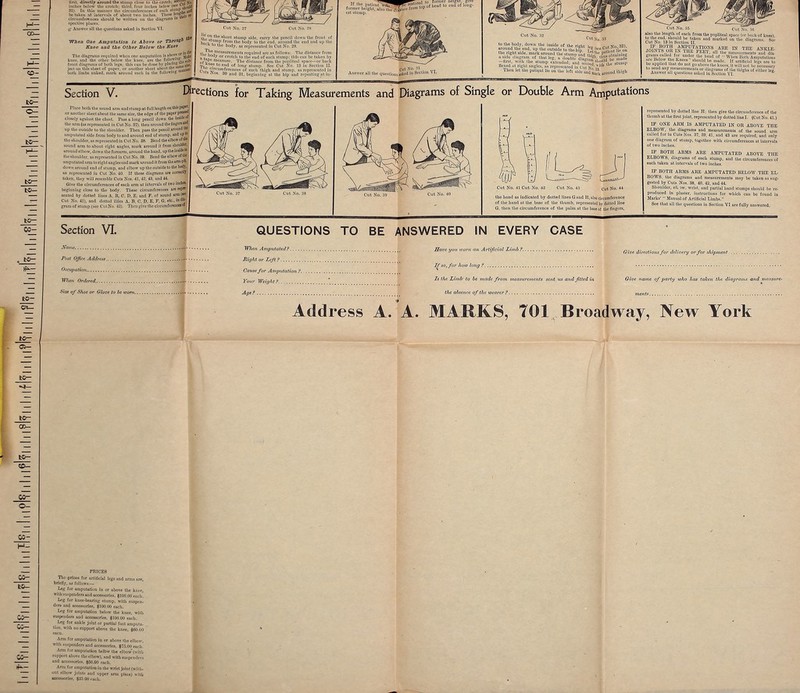 «0- fc©— to— co- to- os- bc— ©- 05- H— 05- 05- 05- 05- lirst. directly around the slump close In the itkIi'Ii; ,'..['No- inches Iwtow the crotch; third, four iuches 31). Iu tliis mnniicr the circumferences of each sli11! . ,,,„! betaken .-it intervals of about two inches. These h,»!j \'st- circumferences should be written on the diagram8 1U spective places. Answer all the questions asked in Section VI. When One Amputation Is Above or Through Knee and the Other Below the Knee The diagrams required when one amputation is aboW °r !Jj^c kiiei' und'the oltu'v bi'lnw the kmr, nre I In- f<'ll'iu '^ ,\u\h front diagrams of both legs; this can be done by plfle'nfi , ject on tins sheet of paper, or another sheet about the sua: _ both limbs naked, mark around each iu the following '» lii:i!lWr: l\iC°J! tIie short stump side, carry the pencil down the front of hnnlf ,llIni) from '° bod* to the end. around the end and up the ick to tiie body, as represented in Cut No. 29. II Tjlc 'cnsnremeiits required are as follows: The distance from <- tiody or crotcli to the end of each slump; this can be taken by or ?pe m^nsure. The distance from the poj.litenl space—or back The -C t0 end of ]on£ st,,mP- See Cut No- 13 in Section II. Cuts SlrcilniAeneas of each thigh and stump, ns represented iu 13 JNos. 80 and 31, beginning nt the hip and repeating at iu- , , ^^-^^a^a^^^rM to former iieigni. give If the putiont wj^ ^PU rostore end of loug- fonner height, also the di-W*-' frunl P est stump. Cut No. 31 Answer all the questions asked in Section VI. Cut No. 32 C«t So. 33 ■ Then let the patient lie ou the left side imd«5 around thigh Cut No Cut No. 35 also the length of each from the popliteal space (or back of kneel t/?lUMCndiB.ll0ald )e ',llke ud nmrkert oa lb<) diagrams. s« Cut No. 18 in Section II I0TNl?S°1ol:iNV™?'iT.I,?n?S,,ARE ™ THE ANKLE JOIHIH OK IN lHli FEET, nil the niensuremonlj mid din- ginlns called for urnta ,Le tend of ■■ Wl,cn lioll, Ampu ion, nre Belowtlie Kneej should be „,„dc. ,t „,ill( i„l 1,1, .„ „ bo applied thai do nol go above ,l,c l,„ccs. it „.m ,„„ he to send uny measurements or ,u„gnma of ll,e Iblgli. of either ' Answer nil questions asked in Seetiun VI. Section V. Place both the sound arm and stumpat full length on this rap** or another sheet about the same size, the edge of the paper pressw closely agninst the chest. Pass a long pencil down the insidew the arm (as represented iu Cut No. 37). then around the fingers an« up the outside to the shoulder. Then pass the pencil around Ibe amputated side from body to and around end of stump, and up 1° the shoulder, as represented in Cut No. 38. Bend the elbow of d>* sound arm to about right angles, mark around it from shoulder, around elbow, down the forearm, around the hand, up the inside'0 the shoulder, as represented in Cut No. 39. Bend tlie elbow of tie amputated arm to right angles and mark around it from the urni-P'^ down around end of stump, and elbow up the outside to the bodj, ns represented in Cut No. 40. If these diagrams are correctly taken, they will resemble Cuts Nos. 41, 42, 43, and 44. Give the circumferences of each arm at intervals of two inches beginning close to the body. These circumferences are repre- sented by dotted lines A, B. C, D. E, and F, of sound ann(s« Cut No. 41), and dotted lines A. B. C, D, E, F, G, etc., uro- gram of stump (see Cut No. 42). Then give the circumferences w Directions for Taking Measurements and Diagrams of Single or Double Arm Amputations Cut No. 41 Cut No. 42 Cut No. 43 Cut No. 44 the bund as indicated by dotted lines G-nnd H, also circumference of the hand at the base of the thumb, represented by dotted line G, then the circumference of the palm at the base of the fingers, represented by dotted line H; then give the circumference of the thumb at the first joint, represented by dottedlinel. (Cut No. 41.) IF ONE ARM IS AMPUTATED IN OR ABOVE TEE ELBOW, the diagrams and measurements of the sound arm culled for in Cuts Nos. 37, 3D. 41. and 43 are required, and only one diagram of stump, together with circumferences at intervals of two inches. IF BOTH ARMS ARE AMPUTATED ABOVE THE ELBOWS, diagrams of each stump, and the circumferences of each taken at intervals of two inches. IF BOTH ARMS ARE AMPUTATED BELOW THE EL- BOWS, the diagrams and measurements may be taken as sug- gested by Cuts Nos. 38, 40, 42, and 44. Shoulder, ellw, wrist, and partial hand stumps should be re- produced In plaster, instructions for which cau he found in Marks'  Manual of Artificial Limbs. See that all the questions in Section VI nre fully answered. Section VI. Name. Post Office Address M, Occupation ■ When Ordered. • Size of Shoe or Glove to be worn .n>. QUESTIONS TO BE ANSWERED IN EVERY CASE Wtien Amputated?.... Right or Left? Cause for Amputation.! Tour Weight? Age? Save you worn an Artificial Limb ? JjfsOffor how long f Is the Limb to be made from measureme?its sent us and filed in the absence of the wearer? Give directions for delivery or for shipment. Give name of parly who has taken the diagrams and measure- ments Address A. A. MARKS, 701 Broadway, New York PRICES The prices for artificial legs and arms are, briefly, as follows:— Leg for amputation in or above the knee, with suspenders and accessories, $100.00 each. Leg for knee-bearing stump, with suspen- ded and accessories, $100.00 each. Leg for amputation below the knee, with suspenders and accessories. $100.00 each. Leg for ankle joint or partial foot amputa- tion, with no support above the knee, $80.00 eecn. Arm for amputation In or above Hie elbow, with suspenders and accessories. $73.00 each. Arm for amputation belbw the elbow'(with support above the elbow), and with euspenders and accessories, $50.00 each. Arm for amputation in the wrist Joint (with- out elbow joint* and upper arm piece) w ith Uttauorie*, $3-5 00 each.