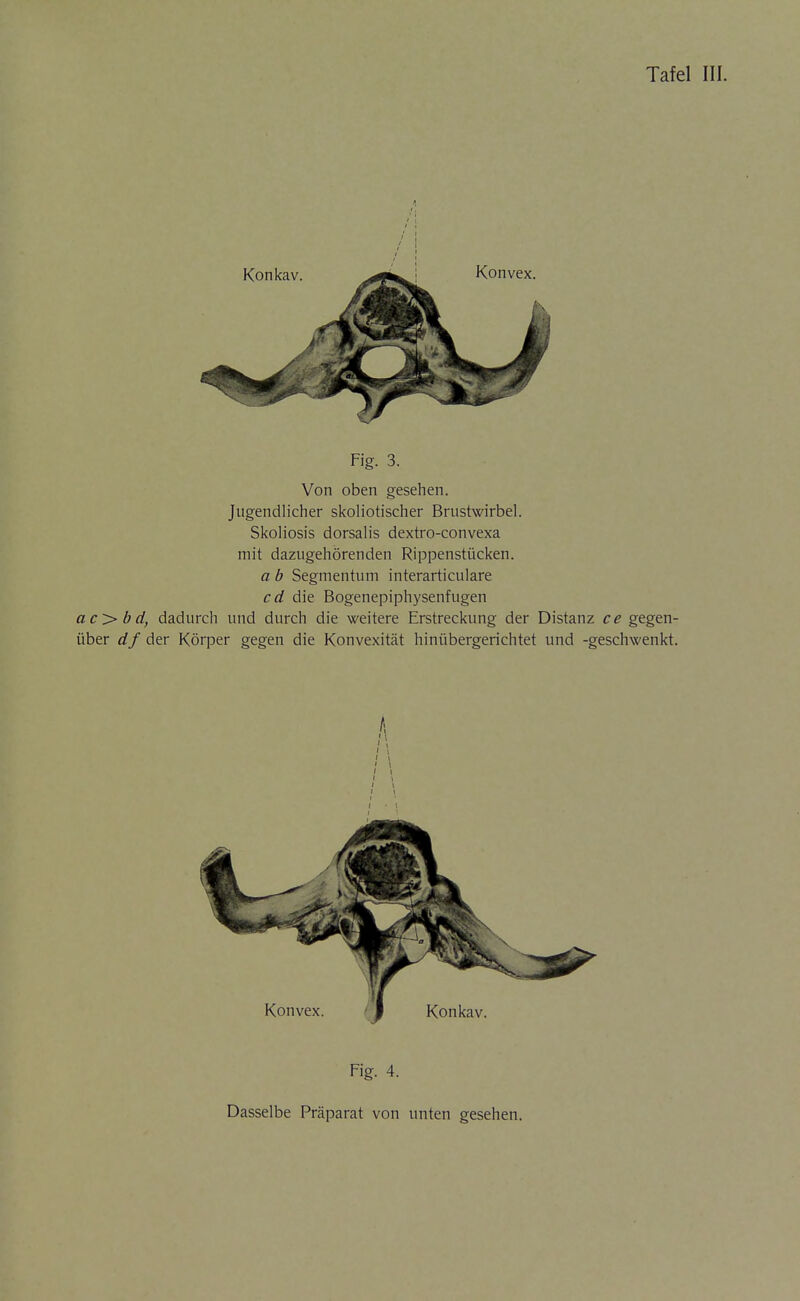 Fig. 3. Von oben gesehen. Jugendlicher skoliotischer Brustwirbel. Skoliosis dorsalis dextro-convexa mit dazugehörenden Rippenstücken. a b Segmentum interarticulare cd die Bogenepiphysenfugen ac>bd, dadurch und durch die weitere Erstreckung der Distanz ce gegen- über df der Körper gegen die Konvexität hinübergerichtet und -geschwenkt. Fig. 4. Dasselbe Präparat von unten gesehen.