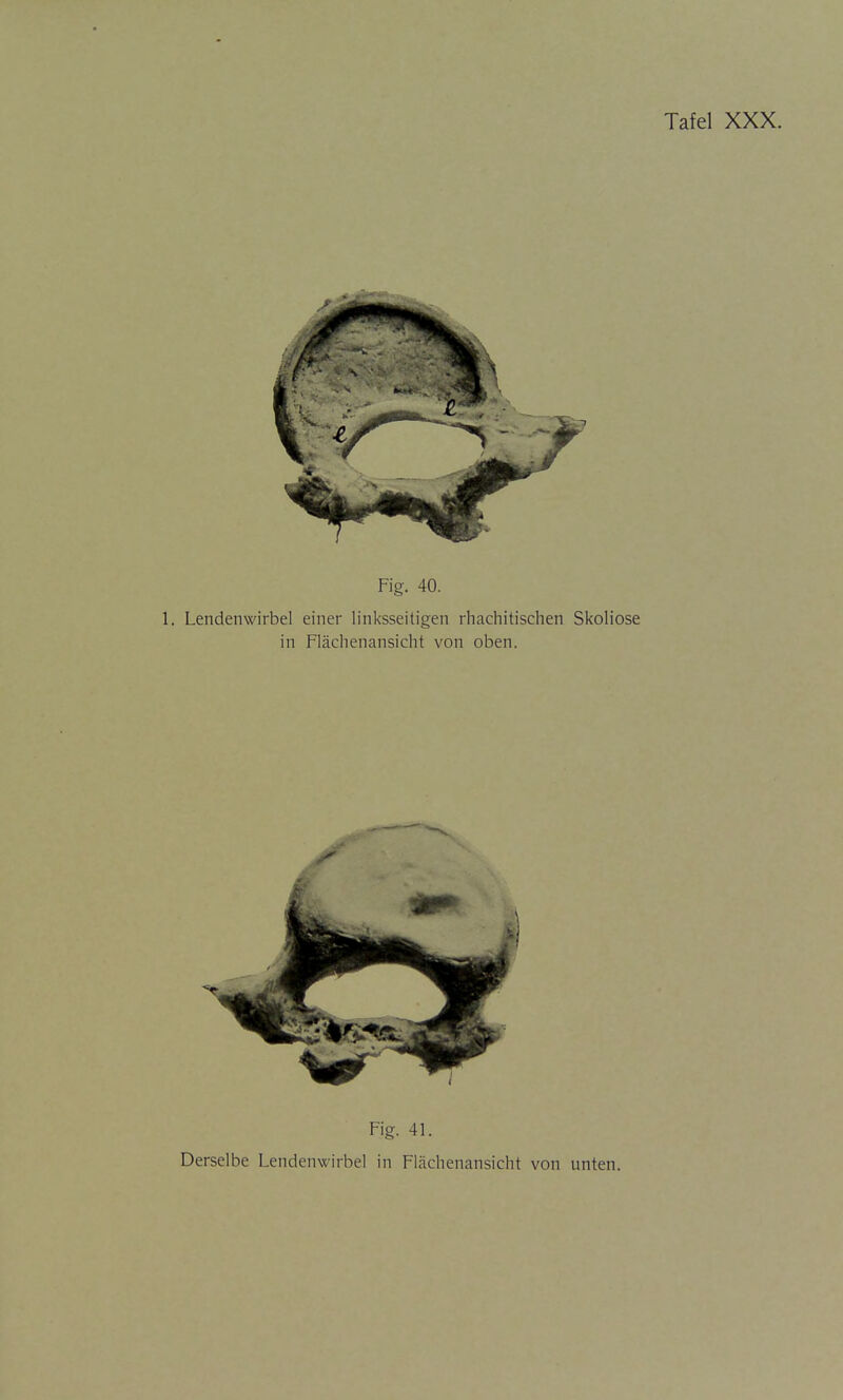 Fig. 41. Derselbe Lendenwirbel in Flächenansicht von unten.