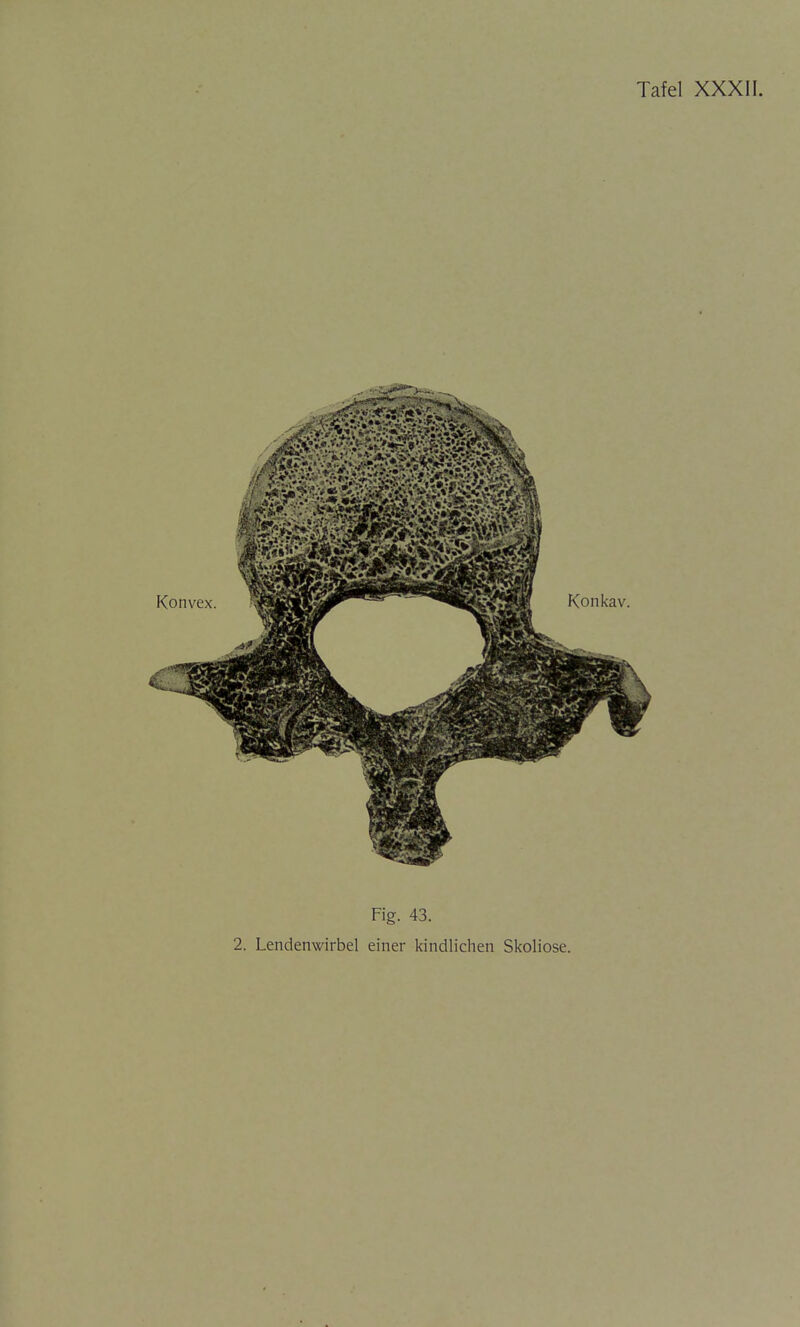 Tafel XXXII. Fig. 43.