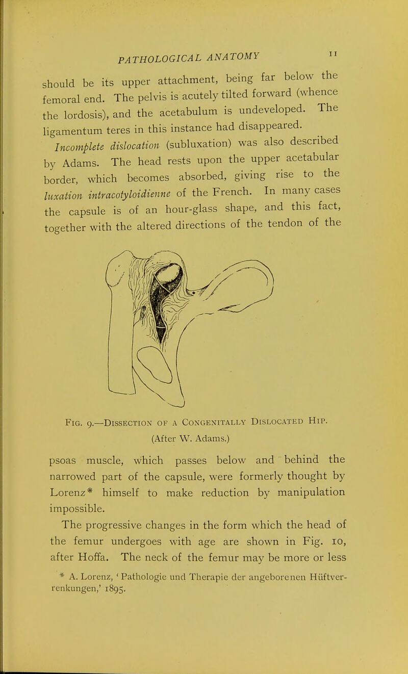 should be its upper attachment, being far below the femoral end. The pelvis is acutely tilted forward (whence the lordosis), and the acetabulum is undeveloped. The ligamentum teres in this instance had disappeared. Incomplete dislocation (subluxation) was also described by Adams. The head rests upon the upper acetabular border, which becomes absorbed, giving rise to the luxation intracotyloidienne of the French. In many cases the capsule is of an hour-glass shape, and this fact, together with the altered directions of the tendon of the Fig. 9.—Dissection of a Coxgexitally Dislocated Hip. (After W. Adams.) psoas muscle, which passes below and behind the narrowed part of the capsule, were formerly thought by Lorenz* himself to make reduction by manipulation impossible. The progressive changes in the form which the head of the femur undergoes with age are shown in Fig. 10, after Hoffa. The neck of the femur may be more or less * A. Lorenz, ' Pathologie und Therapie der angeborenen Hiiftver- renkungen,' 1895.