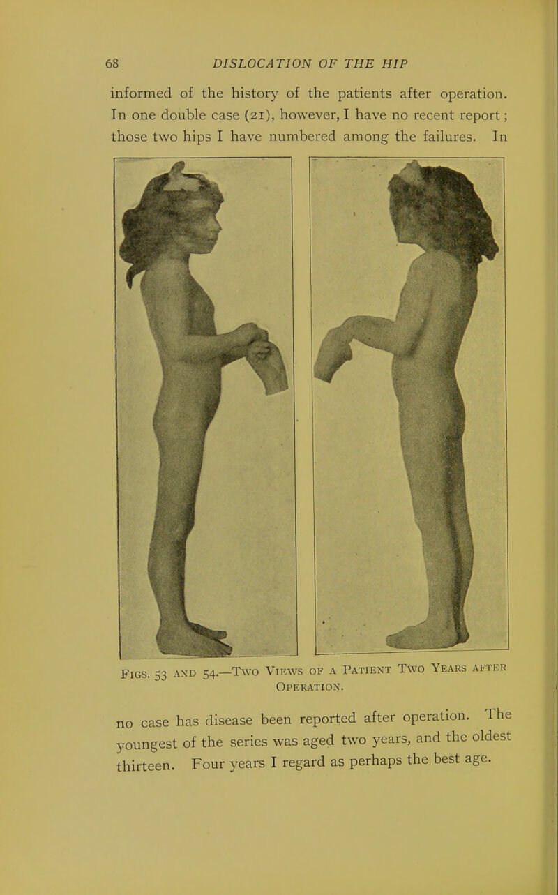 informed of the history of the patients after operation. In one double case (21), however, I have no recent report; those two hips I have numbered among the failures. In Figs. 53 and 54.—Two Views of a Patient Two Years after Operation. no case has disease been reported after operation. The youngest of the series was aged two years, and the oldest thirteen. Four years I regard as perhaps the best age.