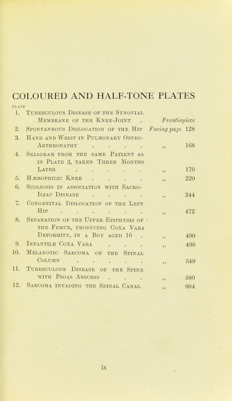 COLOURED AND HALF-TONE PLATES PLATE 1. Ttjberculous Disease of the Synovial Membrane of the Knee-Joint . Frontispiece 2. SpoNTANEOtrs Dislocation of the Hip Facing paje 128 3. Hand and Wrist in Pulmonary Osteo- arthropathy .... „ 168 4. Skiagram from the same Patient as IN Plate 3, taken Three Months Later ..... „ 170 5. HiEMOPHiLic ICnee .... „ 220 6. Scoliosis in association -svith Sacro- iliac Disease .... „ 344 7. Congenital Dislocation of the Left Hip „ 472 8. Separation of the Upper Epiphysis of • the Femur, producing Coxa Vara DEFORmTY, EST A BoY AGED 16 . „ 490 9. Infantile Coxa Vara . . . ,, 496 10. Melanotic Sarcoma of the Spinal Column „ 549 11. Tuberculous Disease of the Spine avith Psoas Abscess ... „ 580 12. Sarcoma invading the Spinal Canal 604