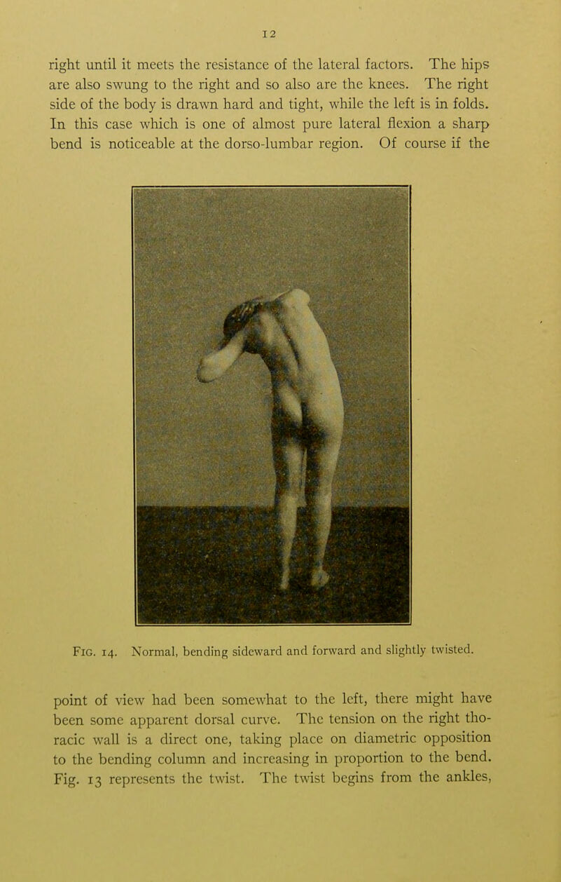 right until it meets the resistance of the lateral factors. The hips are also swung to the right and so also are the knees. The right side of the body is drawn hard and tight, while the left is in folds. In this case which is one of almost pure lateral flexion a sharp bend is noticeable at the dorso-lumbar region. Of course if the Fig. 14. Normal, bending sideward and forward and slightly twisted. point of view had been somewhat to the left, there might have been some apparent dorsal curve. The tension on the right tho- racic wall is a direct one, taking place on diametric opposition to the bending column and increasing in proportion to the bend. Fig. 13 represents the twist. The twist begins from the ankles,