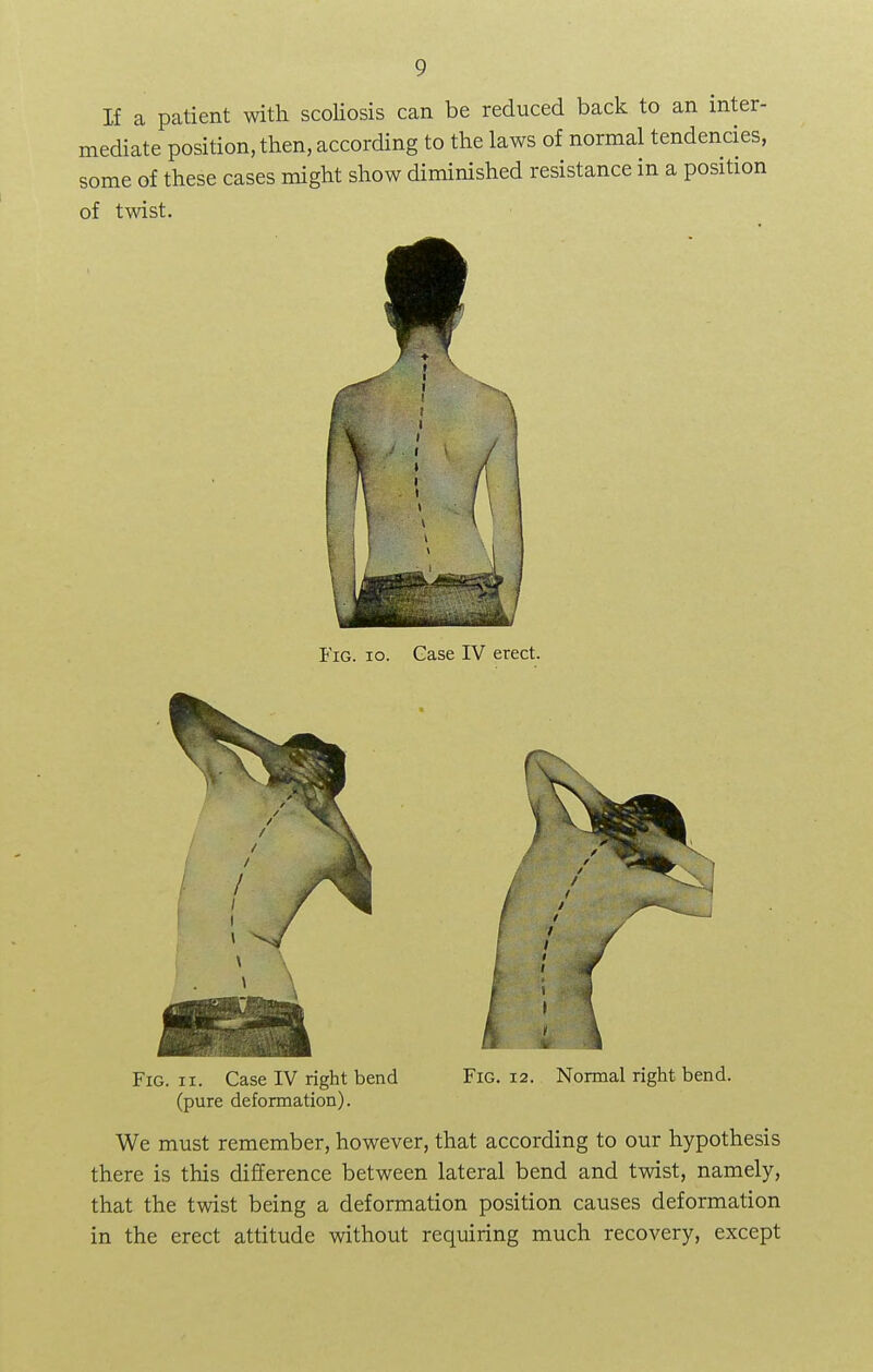 If a patient with scoliosis can be reduced back to an inter- mediate position, then, according to the laws of normal tendencies, some of these cases might show diminished resistance in a position of twist. Fig. io. Case IV erect. 4 i \ Fig. ii. Case IV right bend (pure deformation). Fig. 12. Normal right bend. We must remember, however, that according to our hypothesis there is this difference between lateral bend and twist, namely, that the twist being a deformation position causes deformation in the erect attitude without requiring much recovery, except