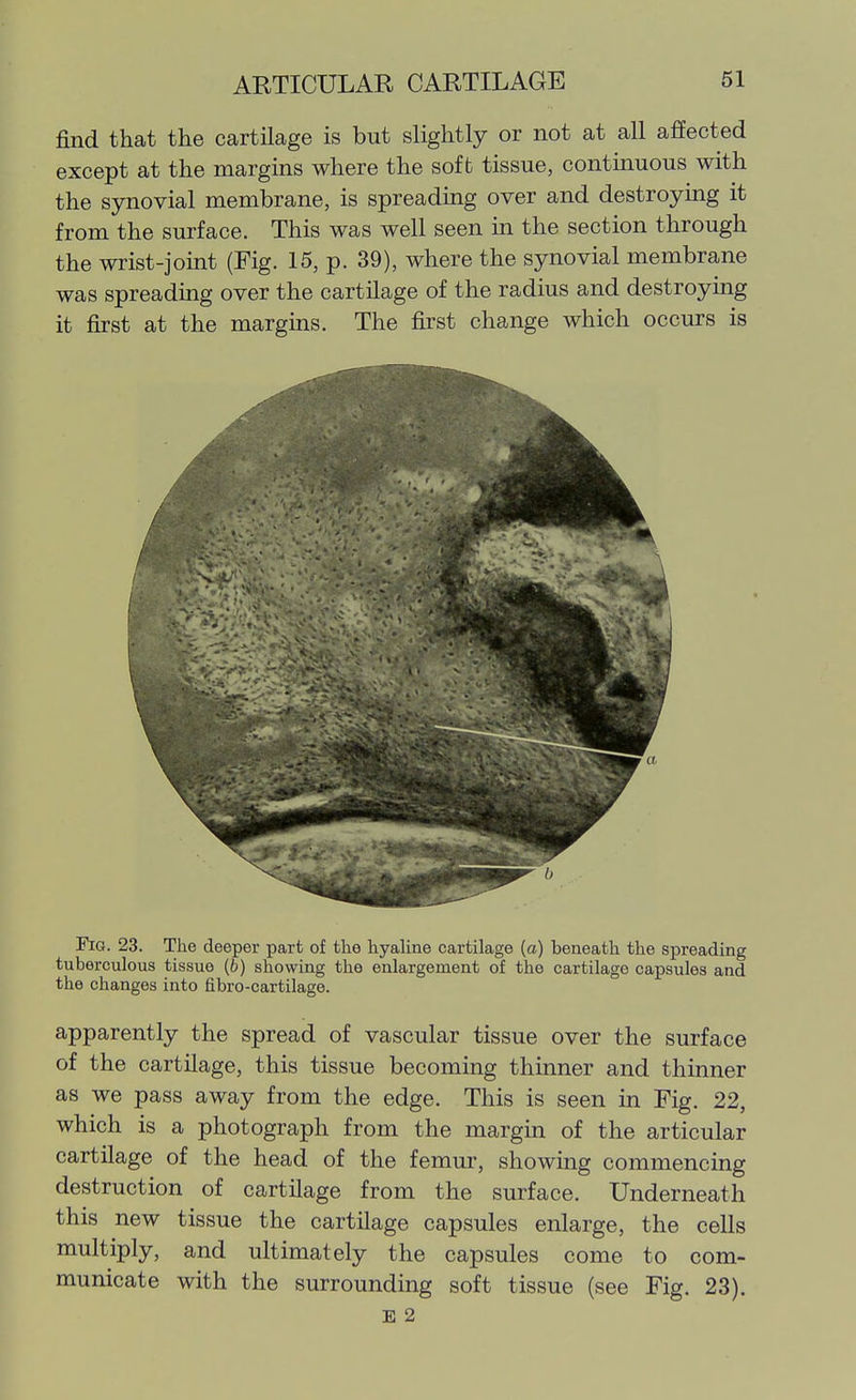 find that the cartilage is but slightly or not at all affected except at the margins where the soft tissue, continuous with the synovial membrane, is spreading over and destroymg it from the surface. This was well seen in the section through the wrist-jomt (Fig. 15, p. 39), where the synovial membrane was spreading over the cartUage of the radius and destroying it first at the margins. The first change which occurs is Fig. 23. The deeper part of the hyaHne cartilage (a) beneath the spreading tuberculous tissue (b) showing the enlargement of the cartilage capsules and the changes into fibro-cartilage. apparently the spread of vascular tissue over the surface of the cartilage, this tissue becoming thinner and thinner as we pass away from the edge. This is seen in Fig. 22, which is a photograph from the margin of the articular cartilage of the head of the femur, showing commencing destruction of cartilage from the surface. Underneath this new tissue the cartilage capsules enlarge, the cells multiply, and ultimately the capsules come to com- municate with the surrounding soft tissue (see Fig. 23). E 2