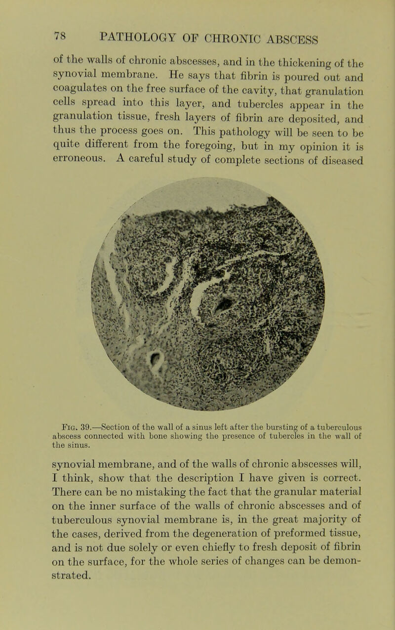 of the walls of chronic abscesses, and in the thickening of the synovial membrane. He says that fibrin is poured out and coagulates on the free surface of the cavity, that granulation cells spread into this layer, and tubercles appear in the granulation tissue, fresh layers of fibrm are deposited, and thus the process goes on. This pathology will be seen to be quite different from the foregomg, but in my opinion it is erroneous. A careful study of complete sections of diseased Fig. 39.—Section of the wall of a sinus left after the bursting of a tuberculous abscess connected with bone showing the presence of tubercles in the wall of the sinus. synovial membrane, and of the walls of chronic abscesses will, I think, show that the description I have given is correct. There can be no mistaking the fact that the granular material on the inner surface of the walls of chronic abscesses and of tuberculous synovial membrane is, in the great majority of the cases, derived from the degeneration of preformed tissue, and is not due solely or even chiefly to fresh deposit of fibrin on the surface, for the whole series of changes can be demon- strated.