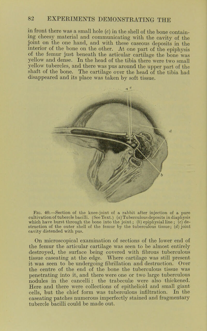 in front there was a small hole (c) in the shell of the bone contain- ing cheesy material and communicating with the cavity of the joint on the one hand, and with these caseous deposits in the interior of the bone on the other. At one part of the epiphysis of the femur just beneath the articular cartilage the bone was yellow and dense. In the head of the tibia there were two small yellow tubercles, and there was pus around the upper part of the shaft of the bone. The cartilage over the head of the tibia had disappeared and its place was taken by soft tissue. Fig. 40.—Section of the knee-joint of a rabbit after injection of a pure cultivation of tubercle bacilli. (See Text.) (a) Tuberculous deposits in diaphysis which have burst through the bone into the joint; {b) epiphysial line ; (c) de- struction of the outer shell of the femur by the tuberculous tissue; [d) joint cavity distended with pus. On microscopical examination of sections of the lower end of the femur the articular cartilage was seen to be almost entirely destroyed, the surface being covered with fibrous tuberculous tissue caseating at the edge. Where cartilage was still present it was seen to be undergoing fibrillation and destruction. Over the centre of the end of the bone the tuberculous tissue Avas penetrating into it, and there were one or two large tuberculous nodules in the cancelli: the trabeculse were also thickened. Here and there Avere collections of ej)ithelioid and small giant cells, but the chief form was tuberculous infiltration. In the caseating patches numerous imj)erfectly stained and fragmentary tubercle bacilli could be made out.