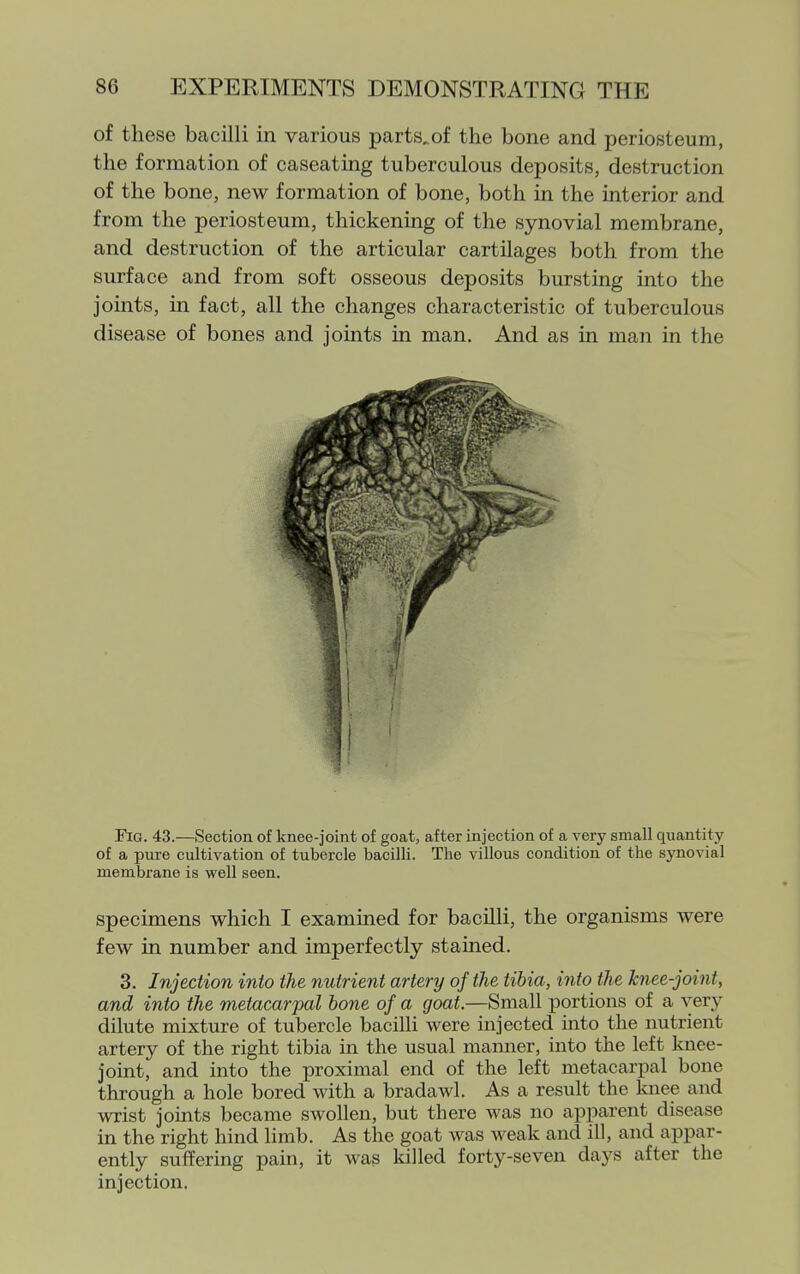 of these bacilli in various parts,of the bone and periosteum, the formation of caseating tuberculous deposits, destruction of the bone, new formation of bone, both in the interior and from the periosteum, thickening of the synovial membrane, and destruction of the articular cartilages both from the surface and from soft osseous deposits bursting into the joints, in fact, all the changes characteristic of tuberculous disease of bones and joints in man. And as in man in the Fig. 43.—Section of knee-joint of goat, after injection of a very small quantity of a pure cultivation of tubercle bacilli. The villous condition of the sjmovial membrane is well seen. specimens which I examined for bacilli, the organisms were few in number and imperfectly stained. 3. Injection into the nutrient artery of the tibia, into the knee-joint, and into the metacarpal hone of a goat.—Small portions of a very dilute mixture of tubercle bacilli were injected into the nutrient artery of the right tibia in the usual manner, into the left knee- joint, and into the proximal end of the left metacarpal bone through a hole bored with a bradawl. As a result the knee and wrist joints became swollen, but there was no apparent disease in the right hind limb. As the goat was weak and ill, and appar- ently suffering pain, it was killed forty-seven days after the injection.