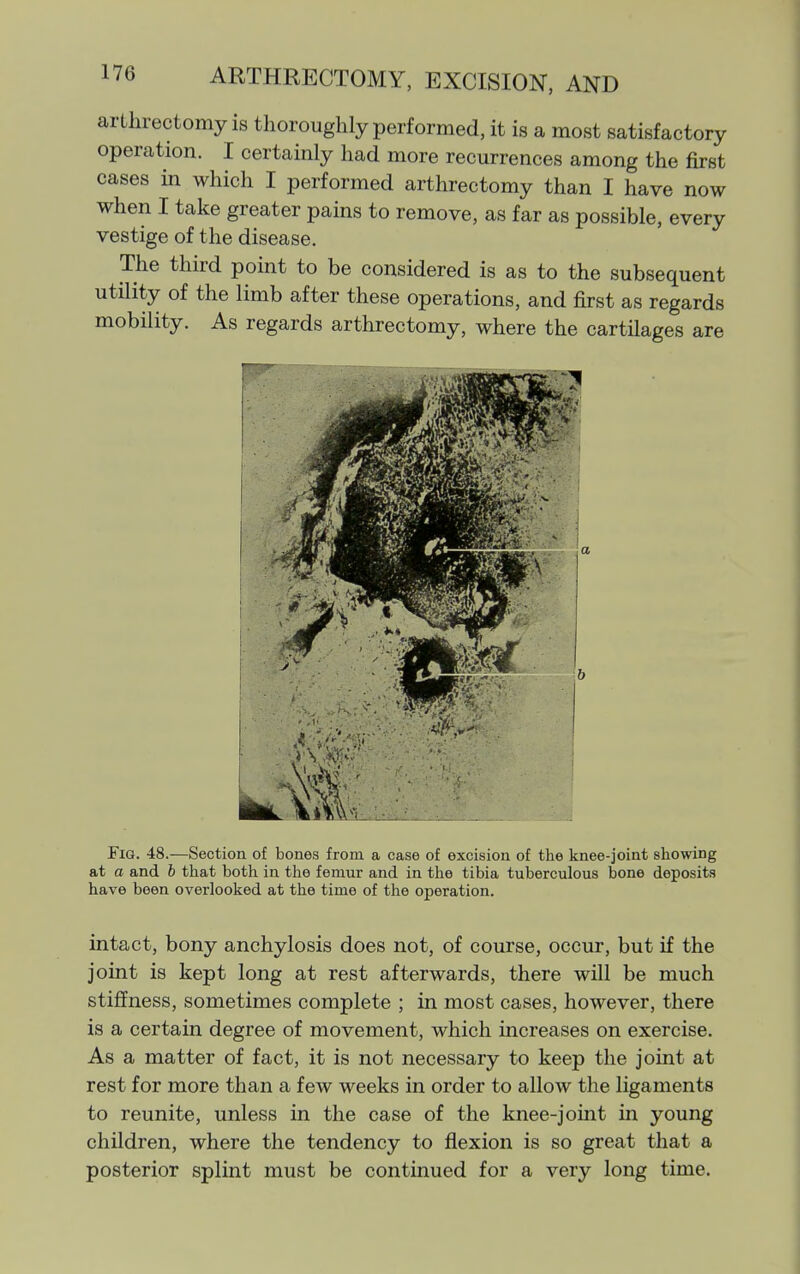 arthrectomy is thoroughly performed, it is a most satisfactory operation. I certainly had more recurrences among the first cases in which I performed arthrectomy than I have now when I take greater pains to remove, as far as possible, every vestige of the disease. The third point to be considered is as to the subsequent utility of the limb after these operations, and first as regards mobility. As regards arthrectomy, where the cartilages are Fig. 48.—Section of bones from a case of excision of the knee-joint showing at a and h that both in the femur and in the tibia tuberculous bone deposits have been overlooked at the time of the operation. intact, bony anchylosis does not, of course, occur, but if the joint is kept long at rest afterwards, there will be much stiffness, sometimes complete ; in most cases, however, there is a certain degree of movement, which increases on exercise. As a matter of fact, it is not necessary to keep the joint at rest for more than a few weeks in order to allow the ligaments to reunite, unless in the case of the knee-joint in young children, where the tendency to flexion is so great that a posterior splint must be continued for a very long time.