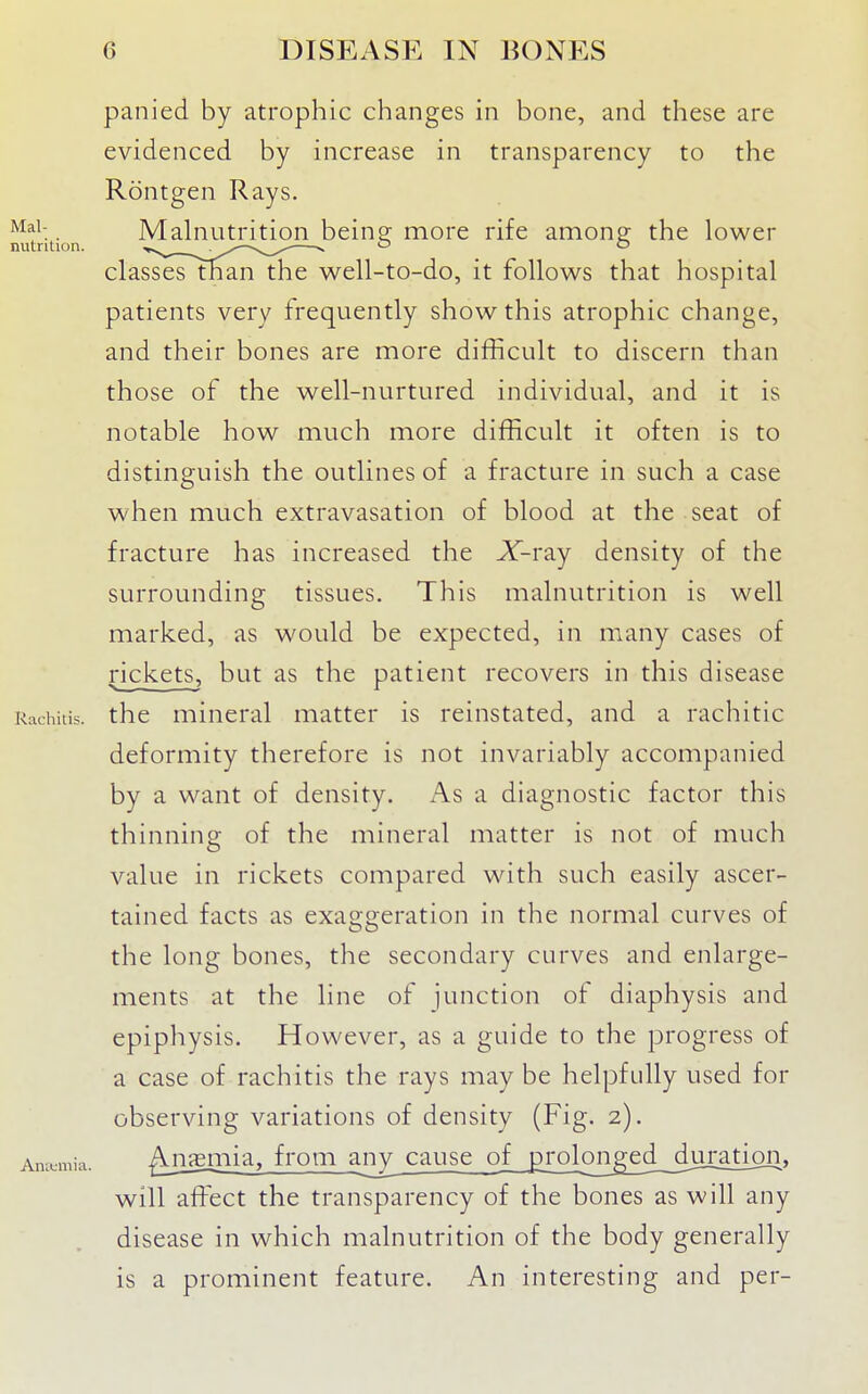 panied by atrophic changes in bone, and these are evidenced by increase in transparency to the Rontgen Rays. . Malnutrition beine more rife amone the lower nutrition. classestnan the well-to-do, it follows that hospital patients very frequently show this atrophic change, and their bones are more difficult to discern than those of the well-nurtured individual, and it is notable how much more difficult it often is to distinguish the outlines of a fracture in such a case when much extravasation of blood at the seat of fracture has increased the X-ray density of the surrounding tissues. This malnutrition is well marked, as would be expected, in many cases of rickets, but as the patient recovers in this disease Kachitis. the mineral matter is reinstated, and a rachitic deformity therefore is not invariably accompanied by a want of density. As a diagnostic factor this thinning of the mineral matter is not of much value in rickets compared with such easily ascer- tained facts as exaggeration in the normal curves of the long bones, the secondary curves and enlarge- ments at the line of junction of diaphysis and epiphysis. However, as a guide to the progress of a case of rachitis the rays may be helpfully used for observing variations of density (Fig. 2). Anttmia. ^u^iia, froui any cause of prolonged diiration, will affisct the transparency of the bones as will any disease in which malnutrition of the body generally is a prominent feature. An interesting and per-