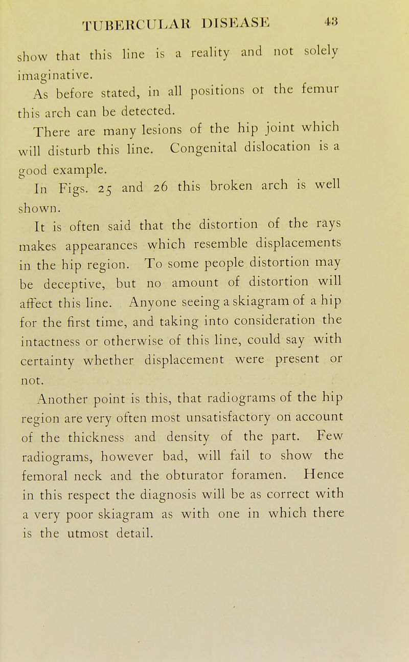 show that this hne is a reaHty and not solely imaginative. As before stated, in all positions ot the femur this arch can be detected. There are many lesions of the hip joint which will disturb this line. Congenital dislocation is a good example. In Figs. 25 and 26 this broken arch is well shown. It is often said that the distortion of the rays makes appearances which resemble displacements in the hip region. To some people distortion may be deceptive, but no amount of distortion will affect this Hne. Anyone seeing a skiagram of a hip for the first time, and taking into consideration the intactness or otherwise of this line, could say with certainty whether displacement were present or not. Another point is this, that radiograms of the hip region are very often most unsatisfactory on account of the thickness and density of the part. Few radiograms, however bad, will fail to show the femoral neck and the obturator foramen. Hence in this respect the diagnosis will be as correct with a very poor skiagram as with one in which there is the utmost detail.