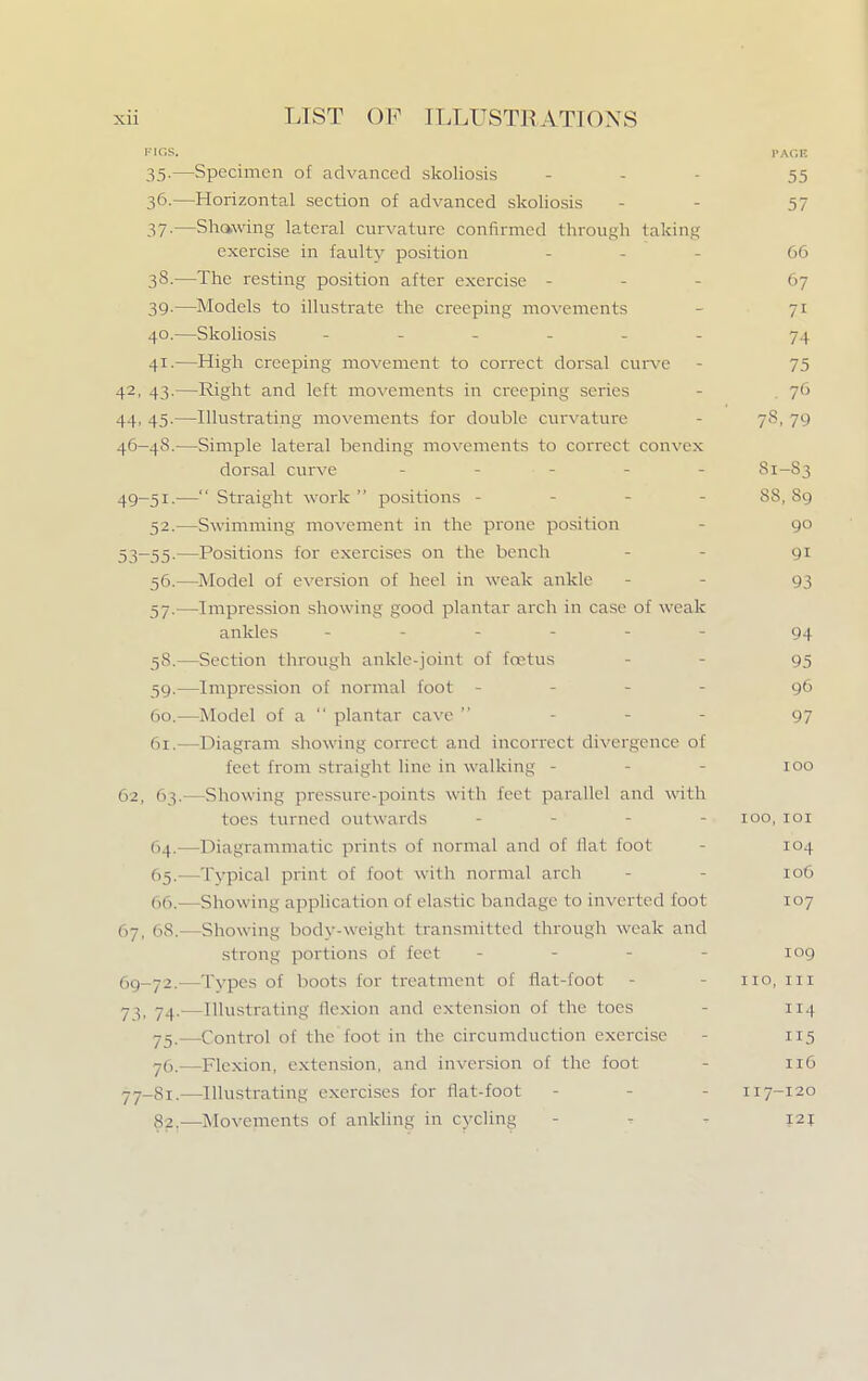 FIGS. PAGE 35. —Specimen of advanced skoliosis - - - 55 36. —Horizontal section of advanced skoliosis - - 57 37-—Showing lateral curvature confirmed through taking exercise in faulty position ... 66 38. —The resting position after exercise - 67 39. —Models to illustrate the creeping movements 71 40. —Skoliosis ------ 74 41. —High creeping movement to correct dorsal curve - 75 42, 43.—Right and left movements in creeping series 76 44,45.—Illustrating movements for double curvature 78, 79 46-48.—Simple lateral bending movements to correct convex dorsal curve - • - - - 81-S3 49-51.— Straight work  positions - ss- s.. 52.—Swimming movement in the prone position 90 53-55.—Positions for exercises on the bench - - 91 56. —Model of eversion of heel in weak ankle - - 93 57. —Impression showing good plantar arch in case of weak ankles ------ 94 58. —Section through ankle-joint of foetus - 95 59. —Impression of normal foot - 96 60. —Model of a  plantar cave  - 97 61. —Diagram showing correct and incorrect divergence of feet from straight line in walking - - - 100 62, 63.—Showing pressure-points with feet parallel and with toes turned outwards 100,101 64. -—Diagrammatic prints of normal and of flat foot 104 65. —Typical print of foot with normal arch - - 106 66. —Showing application of elastic bandage to inverted foot 107 67, 68. Showing body-weight transmitted through weak and strong portions of feet - - - - 109 69-72.—Types of boots for treatment of flat-foot - - no, 111 73, 74.- Illustrating flexion and extension of the toes 114 75.—Control of the foot in the circumduction exercise - 115 7(1.—Flexion, extension, and inversion of the foot - 116 77-81.—Illustrating exercises for flat-foot - - - n 7-120 82.—Movements of ankling in cycling - , - 121