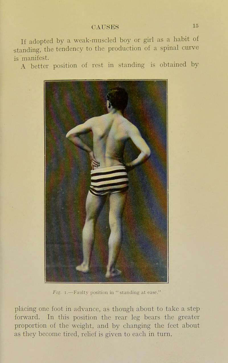 If adopted by a weak-muscled boy or girl as a habit of standing, the tendency to the production of a spinal curve is manifest. A better position of rest in standing is obtained by i Fig. i.—Faulty position in  standing at ease. placing one foot in advance, as though about to take a step forward. In this position the rear leg bears the greater proportion of the weight, and by changing the feet about as they become tired, relief is given to each in turn.