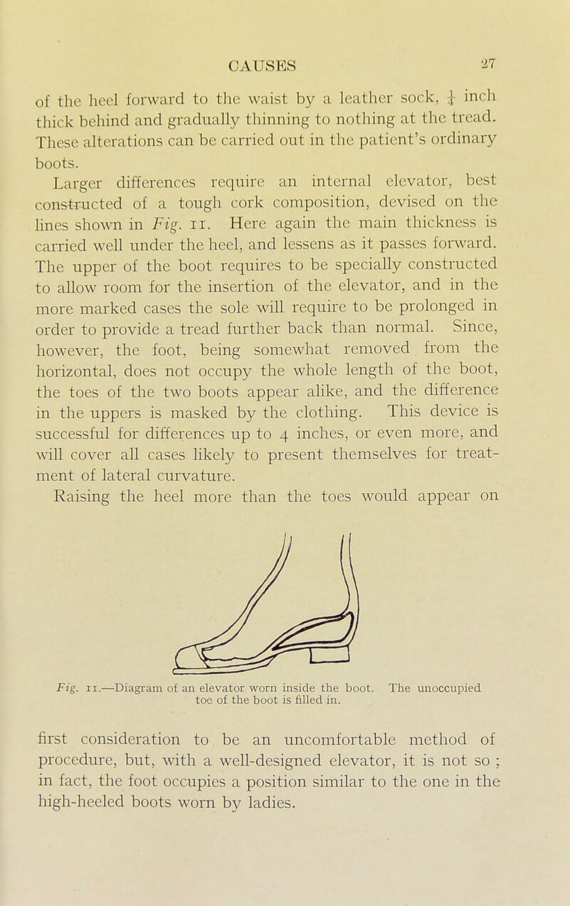 of the heel forward to the waist by a leather sock, | inch thick behind and gradually thinning to nothing at the tread. These alterations can be carried out in the patient's ordinal )' boots. Larger differences require an internal elevator, best constructed of a tough cork composition, devised on the lines shown in Fig. it. Here again the main thickness is carried well under the heel, and lessens as it passes forward. The upper of the boot requires to be specially constructed to allow room for the insertion of the elevator, and in the more marked cases the sole will require to be prolonged in order to provide a tread further back than normal. Since, however, the foot, being somewhat removed from the horizontal, does not occupy the whole length of the boot, the toes of the two boots appear alike, and the difference in the uppers is masked by the clothing. This device is successful for differences up to 4 inches, or even more, and will cover all cases likely to present themselves for treat- ment of lateral curvature. Raising the heel more than the toes would appear on Fig. 11.—Diagram of an elevator worn inside the boot. The unoccupied toe of the boot is filled in. first consideration to be an uncomfortable method of procedure, but, with a well-designed elevator, it is not so : in fact, the foot occupies a position similar to the one in the high-heeled boots worn by ladies.