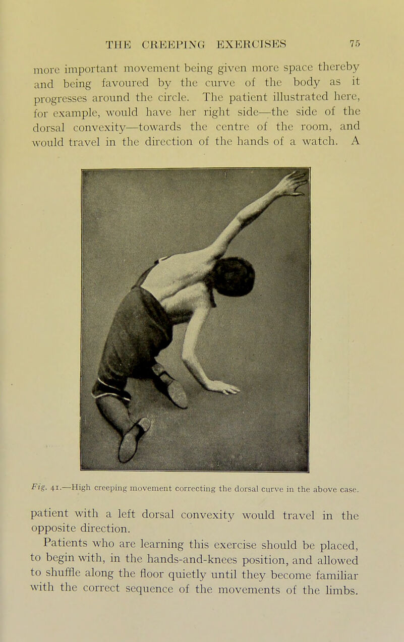 more important movement being given more space thereby and being favoured by the curve of the body as it progresses around the circle. The patient illustrated here, for example, would have her right side—the side of the dorsal convexity—towards the centre of the room, and would travel in the direction of the hands of a watch. A Fig. 41.—High creeping movement correcting the dorsal curve in the above case. patient with a left dorsal convexity would travel in the opposite direction. Patients who are learning this exercise should be placed, to begin with, in the hands-and-knees position, and allowed to shuffle along the floor quietly until they become familiar with the correct sequence of the movements of the limbs.