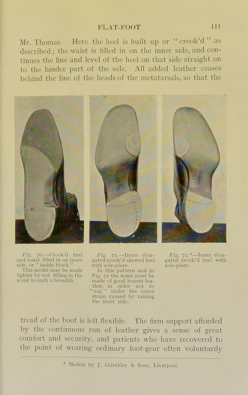 Mr. Thomas. Here the heel is built up or  crook'd  as described; tin-waist is filled in on the inner side, and con- tinues the line and level of the heel on that side straight on to the hinder part of the sole. All added leather ceases behind the line of the heads of the metatarsals, so that the Fig. jo.—Crook'd heel and waist filled in on inner side, or  inside block. This model may be made lighter by not filling in the waist to such a breadth. Fig. 71.—Inner elon- gated crook'd skewed heel with sole-piece. In this pattern and in Fig. 72 the waist must be made of good honest lea- ther, in order not to  sag  under the extra strain caused by raising the inner side. Fig. 72.*—Inner elon- gated crook'd heel with sole-piece. tread of the boot is left flexible. The firm support afforded by the continuous run of leather gives a sense of great comfort and security, and patients who have recovered to the point of wearing ordinary foot-gear often voluntarily * Models by J. Critchley & Sons, Liverpool.