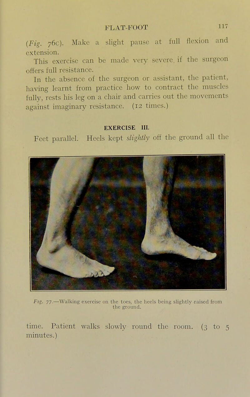 (Fig. 76c). Make a slight pause at full flexion and extension. This exercise can be made very severe if the surgeon offers full resistance. In the absence of the surgeon or assistant, the patient, having learnt from practice how to contract the muscles fully, rests his leg on a chair and carries out the movements against imaginary resistance. (12 times.) EXERCISE III. Feet parallel. Heels kept slightly off the ground all the Fig. 77.—Walking exercise on the toes, the heels being slightly raised from the ground. time. Patient walks slowly round the room. (3 to 5 minutes.)