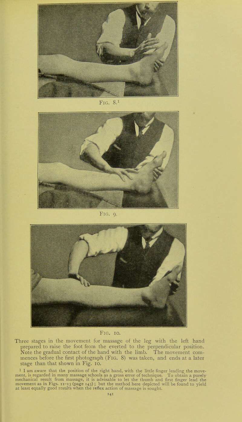 Fig. 8.1 Fig. io. Three stages in the movement for massage of the leg with the left hand prepared to raise the foot from the everted to the perpendicular position. Note the gradual contact of the hand with the limb. The movement com- mences before the first photograph (Fig. 8) was taken, and ends at a later stage than that shown in Fig. lo. 1 I am aware that tlie position of the right hand, with the little finger leading the move- ment, is regarded in many massage schools as a gross error of technique. To obtain a purely mechanical result from massage, it is advisable to let the thumb and first finger lead the movement as in Figs. 11-13 (page 143) ; but the method here depicted will be found to yield at least equally good rssults when the reflex action of massage is sought.