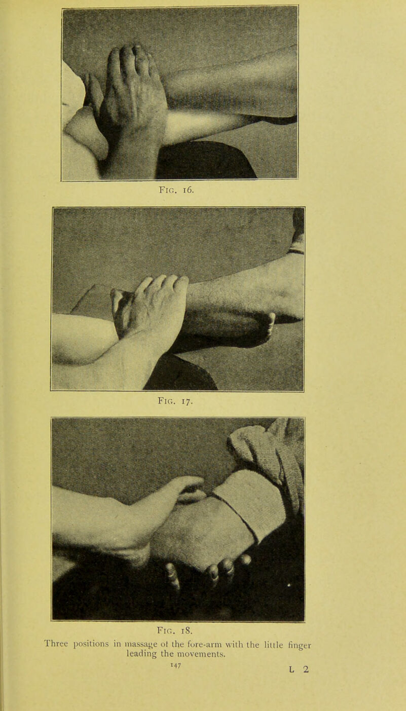 Fir,. i8. Three positions in massage ol the fuie-arm with the Htlle finger leading the movements.