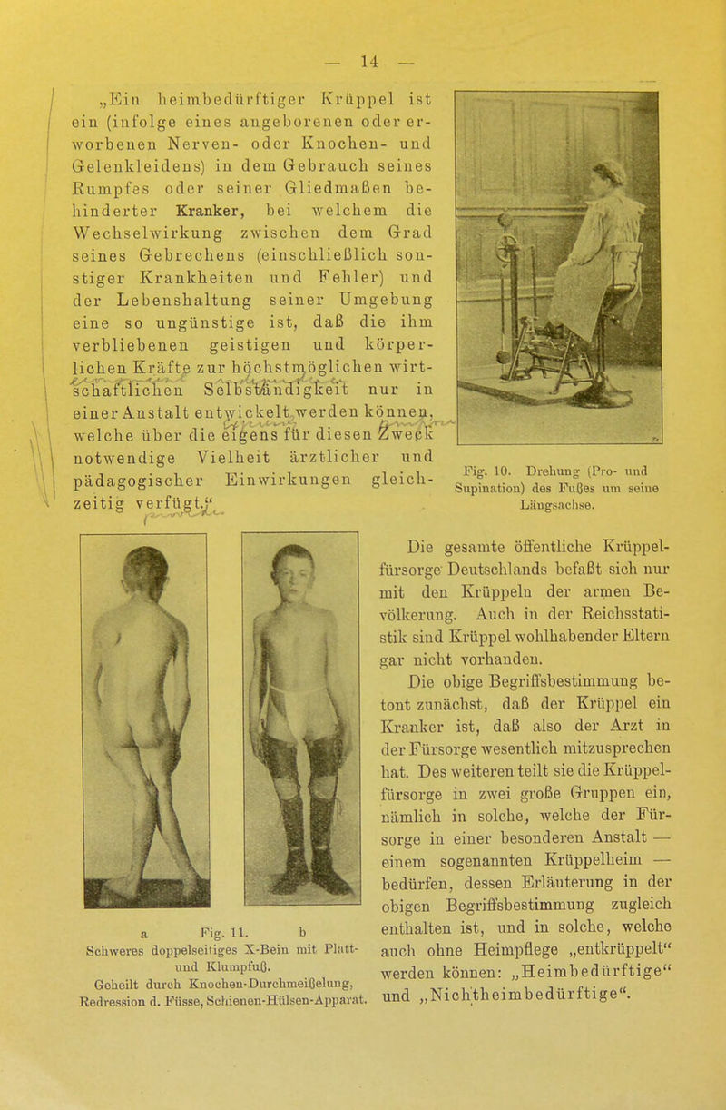 „Ein heimbedürftiger Krüppel ist ein (infolge eines angeborenen oder er- worbenen Nerven- oder Knocben- und Gelenkleidens) in dem Gebrauch seines Rumpfes oder seiner Gliedmaßen be- hinderter Kranker, bei welcbem die Wechselwirkung zwischen dem Grad seines Gebrechens (einschließlich son- stiger Krankheiten und Fehler) und der Lebenshaltung seiner Umgebung eine so ungünstige ist, daß die ihm verbliebenen geistigen und körper- lichen Kräfte zur höchstmöglichen wirt- schaftlichen Selbständigkeit nur in einer Anstalt entwickelt werden können, welche über die etgens für diesen Zweck notwendige Vielheit ärztlicher und pädagogischer Einwirkungen gleich- zeitig verfügt.;' Fig. 10. Drehung; (Pro- und Supination) des Fußes um seine Längsachse. a Fig. 11. b Schweres doppelseitiges X-Bein mit Platt- und Klumpfuß. Geheilt durch Knochen-Durchmeißelung, Redression d. Füsse, Schienen-Hülsen-Apparat. Die gesamte öffentliche Krüppel- fürsorge Deutschlands befaßt sich nur mit den Krüppeln der armen Be- völkerung. Auch in der Reichsstati- stik sind Krüppel wohlhabender Eltern gar nicht vorhanden. Die obige Begriffsbestimmung be- tont zunächst, daß der Krüppel ein Kranker ist, daß also der Arzt in der Fürsorge wesentlich mitzusprechen hat. Des weiteren teilt sie die Krüppel- fürsorge in zwei große Gruppen ein, nämlich in solche, welche der Für- sorge in einer besonderen Anstalt — einem sogenannten Krüppelheim — bedürfen, dessen Erläuterung in der obigen Begriffsbestimmung zugleich enthalten ist, und in solche, welche auch ohne Heimpflege „entkrüppelt werden können: „Heimbedürftige und „Nichtheimbedürftige.