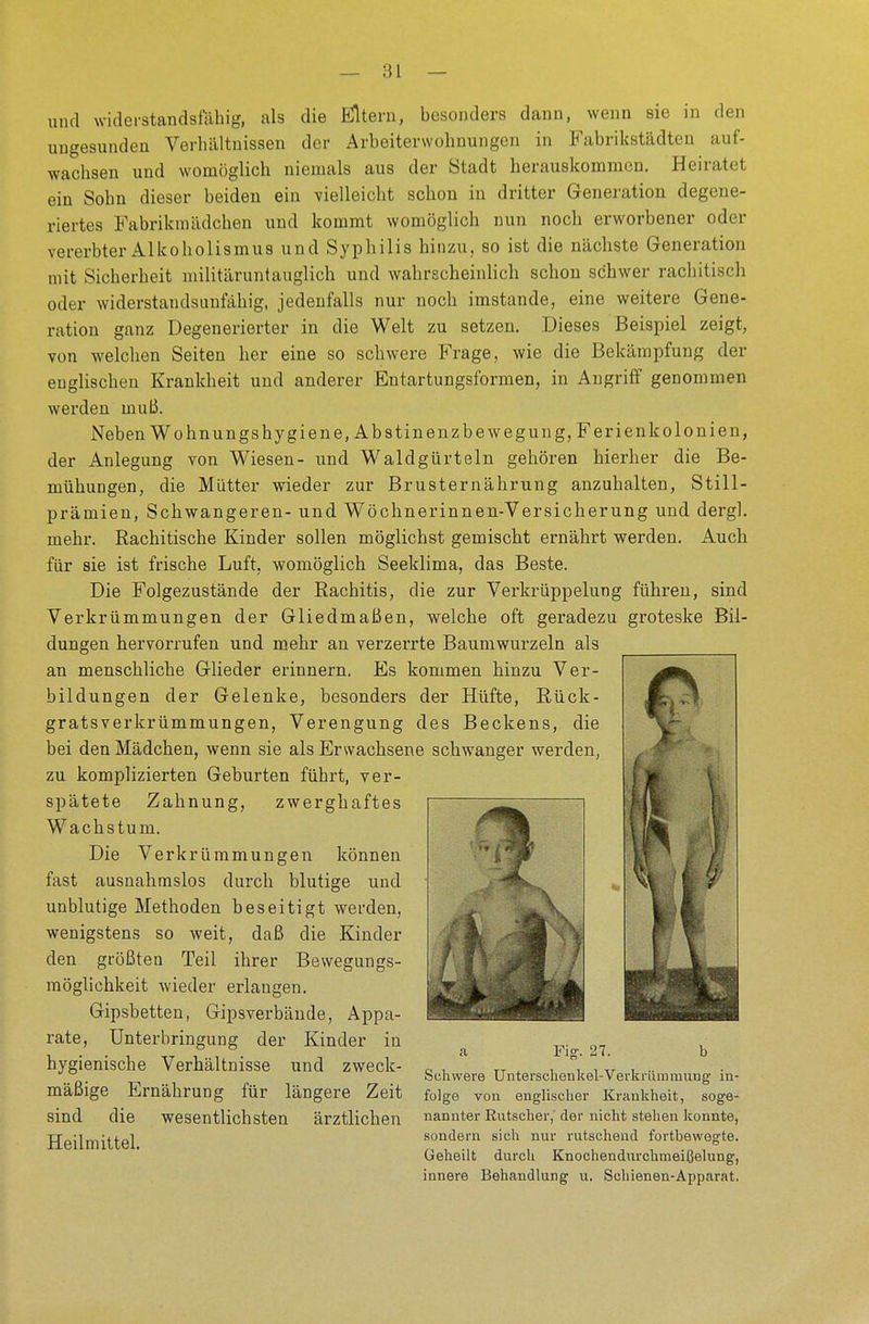 und widerstandsfähig, als die filtern, besonders dann, wenn sie in den ungesunden Verhältnissen der Arbeiterwohnungen in Fabrikstädten auf- wachsen und womöglich niemals aus der Stadt herauskommen. Heiratet ein Sohn dieser beiden ein vielleicht schon in dritter Generation degene- riertes Fabrikmädchen und kommt womöglich nun noch erworbener oder vererbter Alkoholismus und Syphilis hinzu, so ist die nächste Generation mit Sicherheit militäruntauglich und wahrscheinlich schon schwer rachitisch oder widerstandsunfähig, jedenfalls nur noch imstande, eine weitere Gene- ration ganz Degenerierter in die Welt zu setzen. Dieses Beispiel zeigt, von welchen Seiten her eine so schwere Frage, wie die Bekämpfung der englischen Krankheit und anderer Entartungsformen, in Angriff genommen werden muß. Neben Wohnungshygiene, Abstinenzbewegung, Ferienkolonien, der Anlegung von Wiesen- und Waldgürteln gehören hierher die Be- mühungen, die Mütter wieder zur Brusternährung anzuhalten, Still- prämien, Schwangeren- und Wöchnerinnen-Versicherung und dergl. mehr. Rachitische Kinder sollen möglichst gemischt ernährt werden. Auch für sie ist frische Luft, womöglich Seeklima, das Beste. Die Folgezustände der Rachitis, die zur Verkrüppelung führen, sind Verkrümmungen der Gliedmaßen, welche oft geradezu groteske Bil- dungen hervorrufen und mehr an verzerrte Baum wurzeln als an menschliche Glieder erinnern. Es kommen hinzu Ver- bildungen der Gelenke, besonders der Hüfte, Rück- gratsverkrümmungen, Verengung des Beckens, die bei den Mädchen, wenn sie als Erwachsene schwanger werden, zu komplizierten Geburten führt, ver- spätete Zahnung, zwerghaftes Wachstum. Die Verkrümmungen können fast ausnahmslos durch blutige und unblutige Methoden beseitigt werden, wenigstens so weit, daß die Kinder den größten Teil ihrer Bewegungs- möglichkeit wieder erlangen. Gipsbetten, Gipsverbände, Appa- rate, Unterbringung der Kinder in hygienische Verhältnisse und zweck- mäßige Ernährung für längere Zeit sind die wesentlichsten ärztlichen Heilmittel. I a Fig. 27. b Schwere Unterschenkel-Verkrümmung in- folge von englischer Krankheit, soge- nannter Rutscher, der nicht stehen konnte, sondern sich nur rutschend fortbewegte. Geheilt durch Knochendurchmeifjelung, innere Behandlung u. Schienen-Apparat.