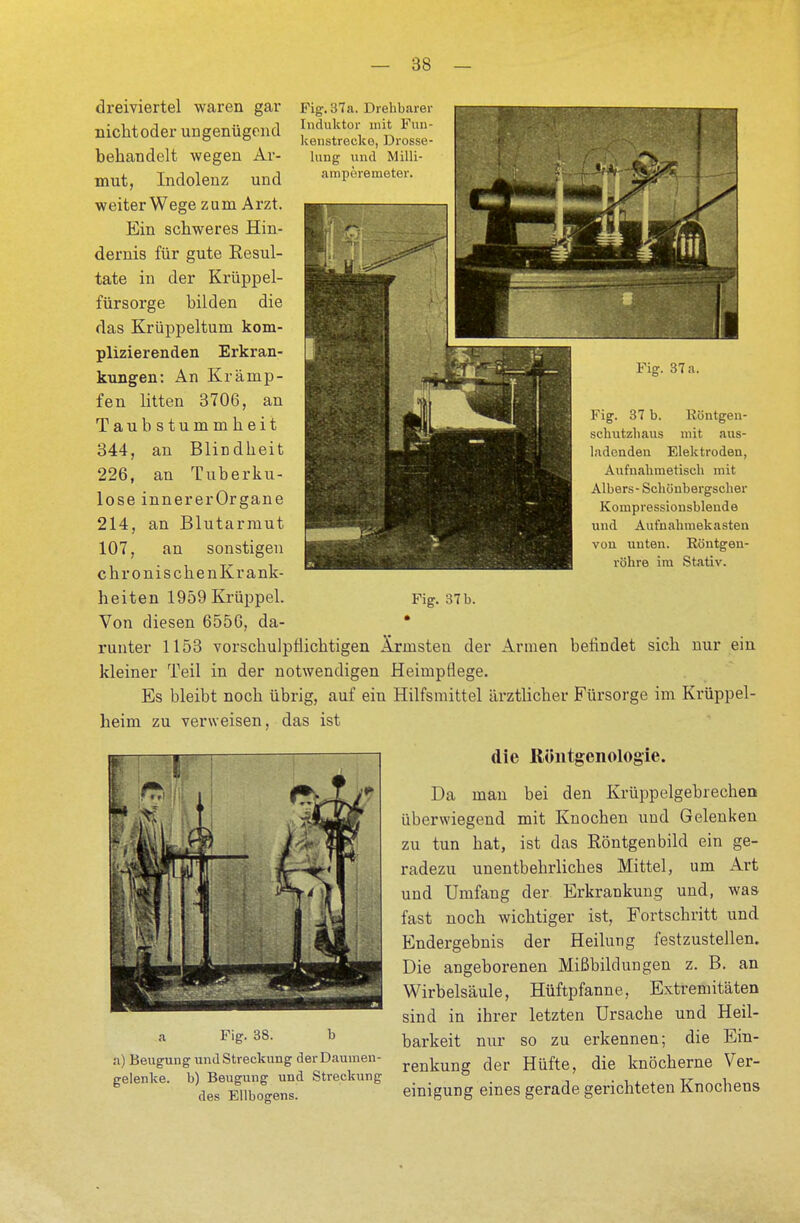 Fig. 37a. Drehbarer Induktor mit Fun- kenstrecke, Drosse- lung und Milli- ampereineter. E Fig. 37 a. Fig. 37 b. Röntgen- schutzhaus mit aus- ladenden Elektroden, Aufnahmetiseh mit Albers- Schönbergscher Kompressionsbleude und Aufnahmekasten von unten. Röntgen- röhre im Stativ. dreiviertel waren gar nichtoder ungenügend behandelt wegen Ar- mut, Indolenz und weiter Wege zum Arzt. Ein schweres Hin- dernis für gute Resul- tate in der Krüppel- fürsorge bilden die das Krüppeltum kom- plizierenden Erkran- kungen: An Krämp- fen litten 3706, an Taubstummheit 344, an Blindheit 226, an Tuberku- lose innererOrgane 214, an Blutarmut 107, an sonstigen ehr oni sehen Krank- heiten 1959 Krüppel. Fig. 37 b. Von diesen 6556, da- • runter 1153 vorschulpfiichtigen Ärmsten der Annen befindet sich nur ein kleiner Teil in der notwendigen Heiinpflege. Es bleibt noch übrig, auf ein Hilfsmittel ärztlicher Fürsorge im Krüppel- heim zu verweisen, das ist die Röntgenologie. Da man bei den Krüppelgebrechen überwiegend mit Knochen und Gelenken zu tun hat, ist das Röntgenbild ein ge- radezu unentbehrliches Mittel, um Art und Umfang der Erkrankung und, was fast noch wichtiger ist, Fortschritt und Endergebnis der Heilung festzustellen. Die angeborenen Mißbildungen z. B. an Wirbelsäule, Hüftpfanne, Extremitäten sind in ihrer letzten Ursache und Heil- Fi£-38- b barkeit nur so zu erkennen; die Ein- a) Beugung und Streckung der Daumen- renkun„ der Hüfte, die knöcherne Ver- b) Beugung und Streckung ° . „ . des Ellbogens. einigung eines gerade gerichteten Knochens a gelenke.