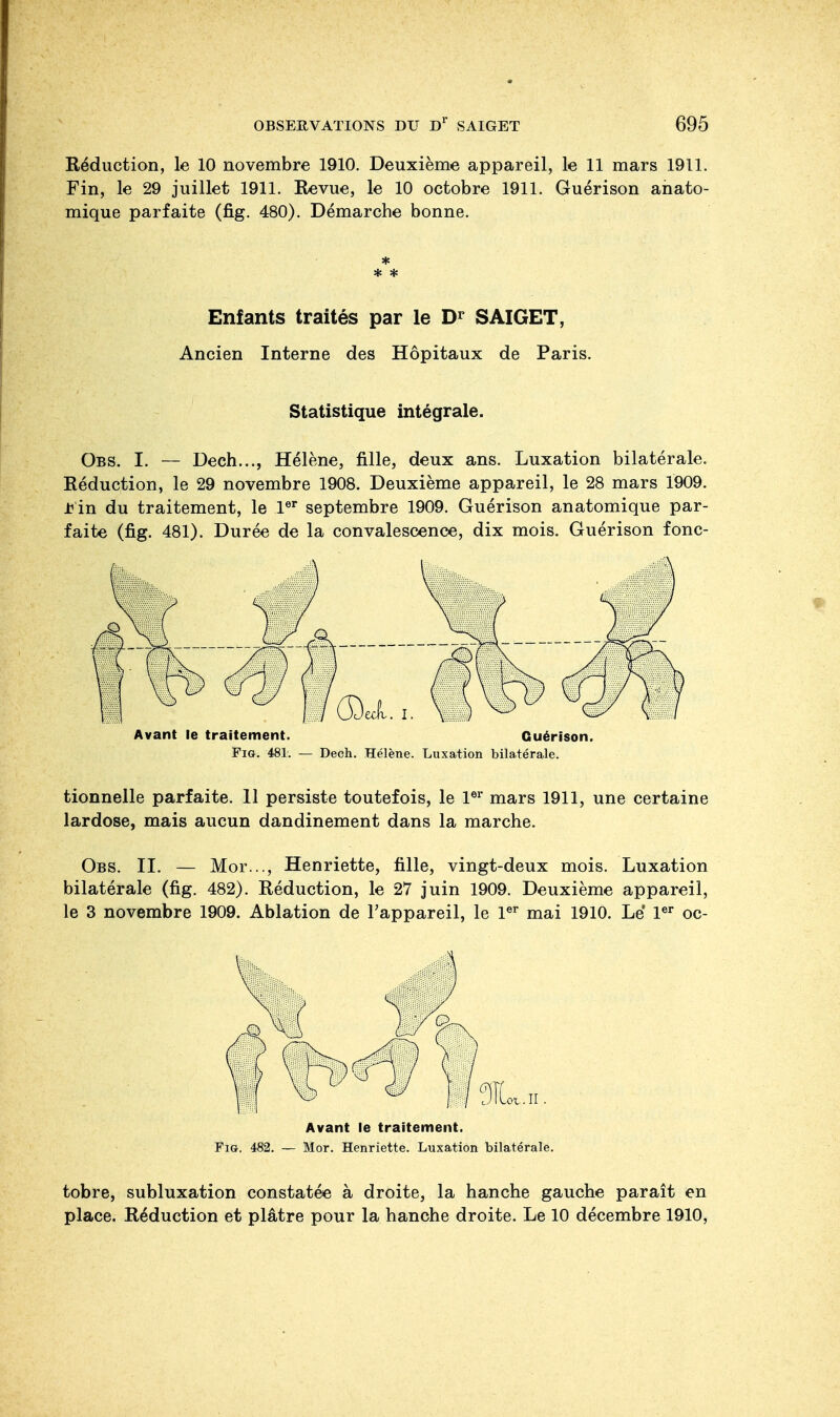 Réduction, le 10 novembre 1910. Deuxième appareil, le 11 mars 1911. Fin, le 29 juillet 1911. Revue, le 10 octobre 1911. Guérison ahato- mique parfaite (fig. 480). Démarche bonne. * * * Enfants traités par le Dr SAIGET, Ancien Interne des Hôpitaux de Paris. Statistique intégrale. Obs. I. — Dech..., Hélène, fille, deux ans. Luxation bilatérale. Réduction, le 29 novembre 1908. Deuxième appareil, le 28 mars 1909. .t in du traitement, le 1er septembre 1909. Guérison anatomique par- faite (fig. 481). Durée de la convalescence, dix mois. Guérison fonc- Avant le traitement. Guérison. Fig. 481. — Dech. Hélène. Luxation bilatérale. tionnelle parfaite. 11 persiste toutefois, le 1er mars 1911, une certaine lardose, mais aucun dandinement dans la marche. Obs. II. — Mor..., Henriette, fille, vingt-deux mois. Luxation bilatérale (fig. 482). Réduction, le 27 juin 1909. Deuxième appareil, le 3 novembre 1909. Ablation de l'appareil, le 1er mai 1910. Le 1er oc- .ot.H . Avant le traitement. Fig. 482. — Mor. Henriette. Luxation bilatérale. tobre, subluxation constatée à droite, la hanche gauche paraît en place. Réduction et plâtre pour la hanche droite. Le 10 décembre 1910,