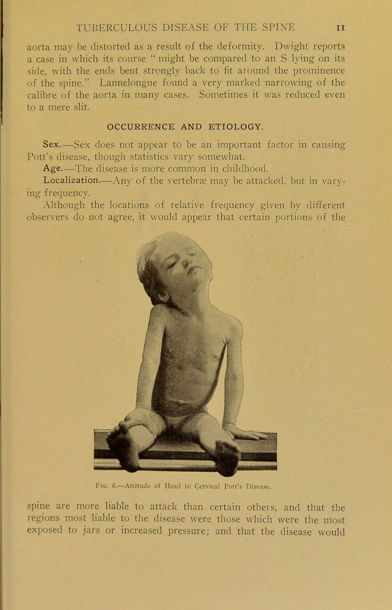 aorta may be distorted as a result of the deformity. Dwight reports a case in w hich its course  might be compared to an S lying on its side, with the ends bent strongly back to fit around the prominence of the spine. Lannelongtie found a very marked narrowing of the calibre of the aorta in many cases. Sometimes it was reduced even to a mere slit. OCCURRENCE AND ETIOLOGY. Sex.—Sex does not appear to be an important factor in causing Pott's disease, though statistics vary somewhat. Age.—The disease is more common in childhood. Localization.—Any of the vertebrae may be attacked, but in vary- ing frequency. Although the locations of relative frequency given by different observers do not agree, it would appear that certain portions of the Fig. 6.—Attitude of Head in Cervical Pott's Disease. spine are more liable to attack than certain others, and that the regions most liable to the disease were those which were the most exposed to jars or increased pressure; and that the disease would