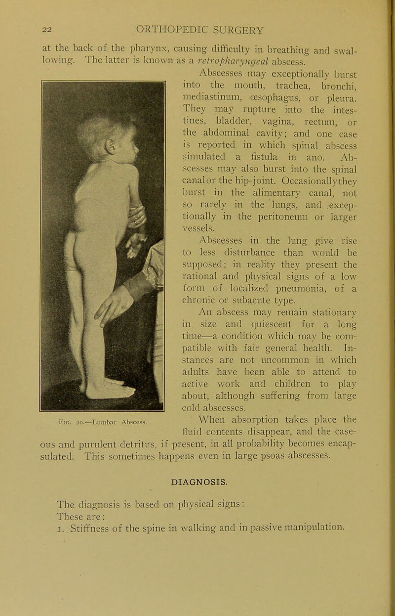 at the back of the pharynx, causing difficulty in breathing and swal- lowing. The latter is known as a retropharyngeal abscess. Abscesses may exceptionally burst into the mouth, trachea, bronchi, mediastinum, oesophagus, or pleura. They may rupture into the intes- tines, bladder, vagina, rectum, or the abdominal cavity; and one case is reported in which spinal abscess simulated a fistula in ano. Ab- scesses may also burst into the spinal canal or the hip-joint. Occasionallythey burst in the alimentary canal, not so rarely in the lungs, and .excep- tionally in the peritoneum or larger vessels. Abscesses in the lung give rise to less disturbance than would be supposed; in reality they present the rational and physical signs of a low form of localized pneumonia, of a chronic or subacute type. An abscess may remain stationary in size and quiescent for a long time—a condition which may be com- patible with fair general health. In- stances are not uncommon in which adults have been able to attend to active work and children to play about, although suffering from large cold abscesses. When absorption takes place the fluid contents disappear, and the case- ous and purulent detritus, if present, in all probability becomes encap- sulated. This sometimes happens even in large psoas abscesses. Fig. 20.—Lumbar Abscess. DIAGNOSIS. The diagnosis is based on physical signs: These are: I. Stiffness of the spine in walking and in passive manipulation.