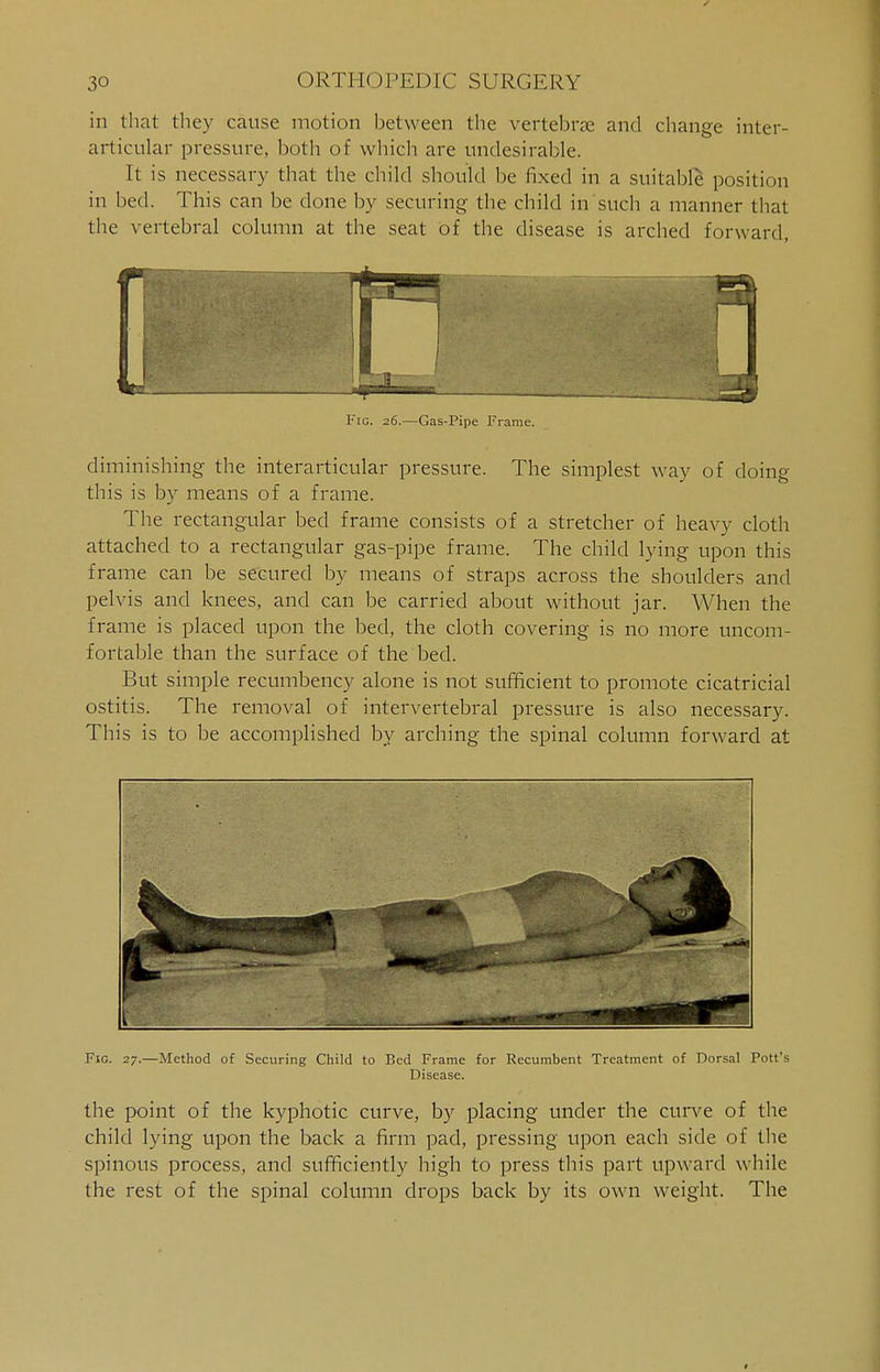 in that they cause motion between the vertebra and change inter- articular pressure, both of which are undesirable. It is necessary that the child should be fixed in a suitable position in bed. This can be done by securing the child in such a manner that the vertebral column at the seat of the disease is arched forward, Fig. 26.—Gas-Pipe Frame. diminishing the interarticular pressure. The simplest way of doing this is by means of a frame. The rectangular bed frame consists of a stretcher of heavy cloth attached to a rectangular gas-pipe frame. The child lying upon this frame can be secured by means of straps across the shoulders and pelvis and knees, and can be carried about without jar. When the frame is placed upon the bed, the cloth covering is no more uncom- fortable than the surface of the bed. But simple recumbency alone is not sufficient to promote cicatricial ostitis. The removal of intervertebral pressure is also necessary. This is to be accomplished by arching the spinal column forward at Fig. 27.—Method of Securing Child to Bed Frame for Recumbent Treatment of Dorsal Pott's Disease. the point of the kyphotic curve, by placing under the curve of the child lying upon the back a firm pad, pressing upon each side of the spinous process, and sufficiently high to press this part upward while the rest of the spinal column drops back by its own weight. The