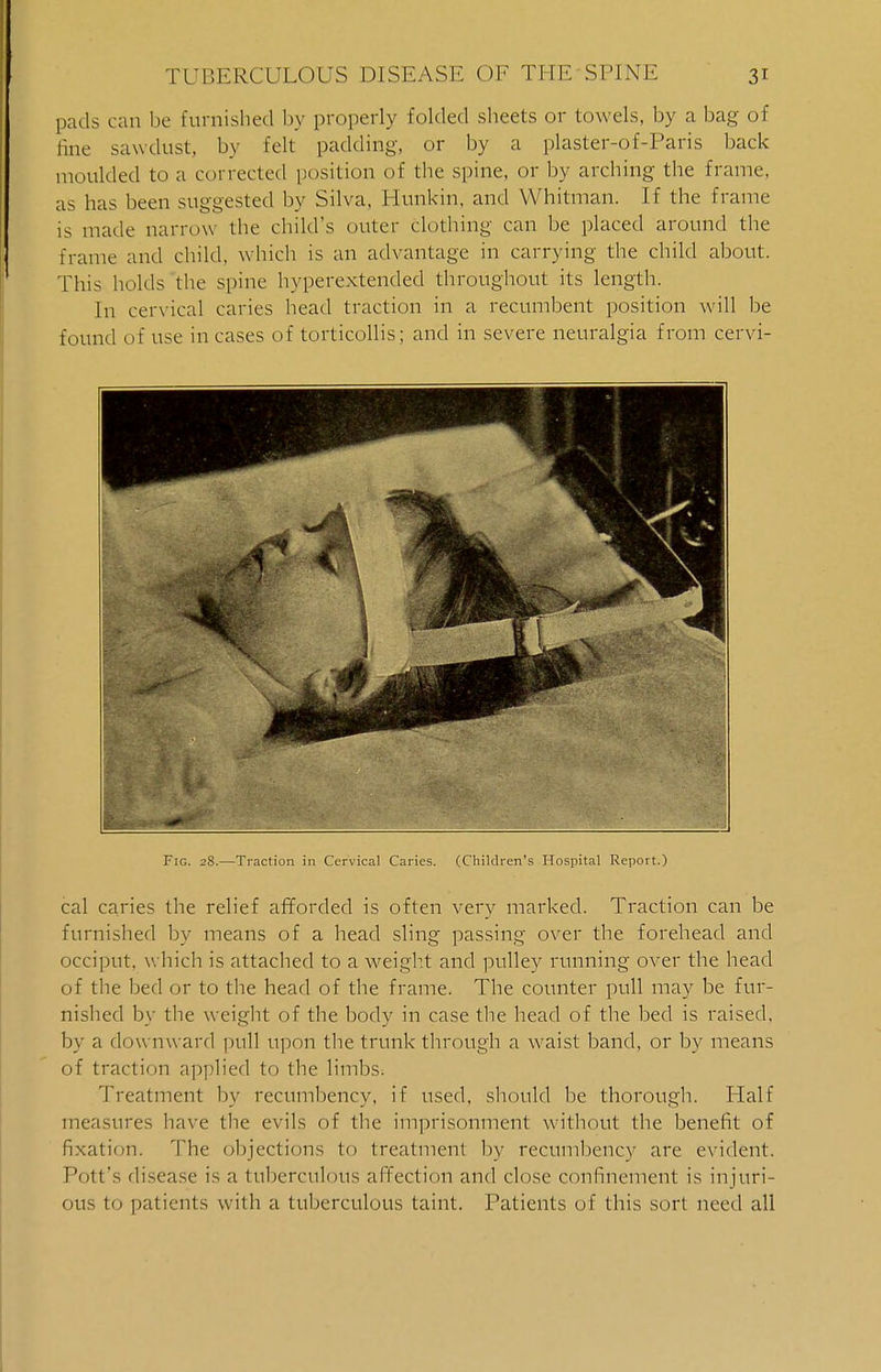 pads can be furnished by properly folded sheets or towels, by a bag of hue sawdust, by felt padding, or by a plaster-of-Paris back moulded to a corrected position of the spine, or by arching the frame, as has been suggested by Silva, Hunkin, and Whitman. If the frame is made narrow the child's outer clothing can be placed around the frame and child, which is an advantage in carrying the child about. This holds the spine hyperextended throughout its length. In cervical caries head traction in a recumbent position will be found of use in cases of torticollis; and in severe neuralgia from cervi- Fig. 28.—Traction in Cervical Caries. (Children's Hospital Report.) cal caries the relief afforded is often very marked. Traction can be furnished by means of a head sling passing over the forehead and occiput, which is attached to a weight and pulley running over the head of the bed or to the head of the frame. The counter pull may be fur- nished by the weight of the body in case the head of the bed is raised, by a downw ard pull upon the trunk through a waist band, or by means of traction applied to the limbs; Treatment by recumbency, if used, should be thorough. Half measures have the evils of the imprisonment without the benefit of fixation. The objections to treatment by recumbency are evident. Pott's disease is a tuberculous affection and close confinement is injuri- ous to patients with a tuberculous taint. Patients of this sort need all