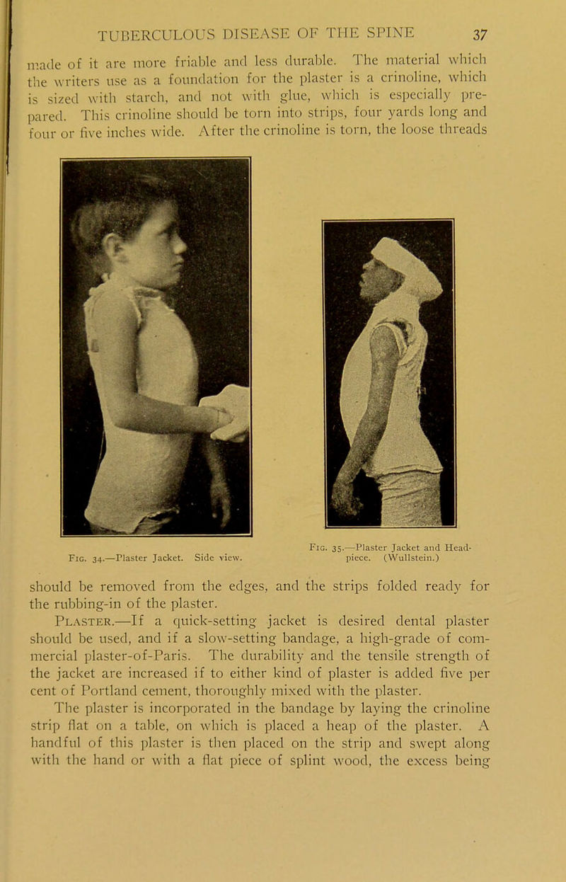 made of it are more friable and less durable. The material which the writers use as a foundation for the plaster is a crinoline, which is sized with starch, and not with glue, which is especially pre- pared. This crinoline should be torn into strips, four yards long and four or live inches wide. After the crinoline is torn, the loose threads Fig. 35.—Plaster Jacket and Head- Fig. 34.—Plaster Jacket. Side view. piece. (Wullstein.) should be removed from the edges, and the strips folded ready for the rubbing-in of the plaster. Plaster.—If a quick-setting jacket is desired dental plaster should be used, and if a slow-setting bandage, a high-grade of com- mercial plaster-of-Paris. The durability and the tensile strength of the jacket are increased if to either kind of plaster is added five per cent of Portland cement, thoroughly mixed with the plaster. The plaster is incorporated in the bandage by laying the crinoline strip flat on a table, on which is placed a heap of the plaster. A handful of this plaster is then placed on the strip and swept along with the hand or with a flat piece of splint wood, the excess being
