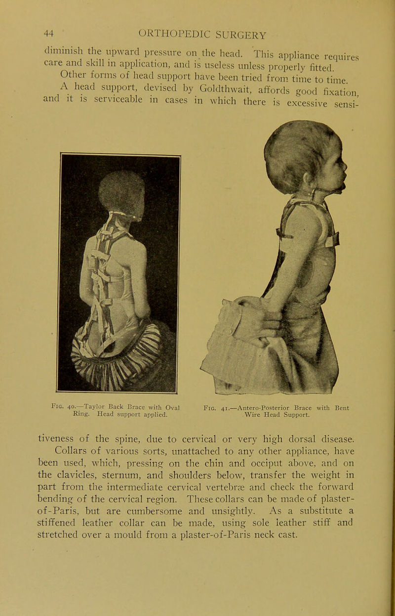 dimmish the upward pressure on the head. This appliance requires care and skill m application, and is useless unless properly fitted. Other forms of head support have been tried from time to time A head support, devised by Goldthwait, affords good fixation and it is serviceable in cases in which there is excessive sensi / Fig. 40.—Taylor Back Brace with Oval Ring. Head support applied. Fig. 41.—Antero-Posterior Brace with Bent Wire Head Support. tiveness of the spine, due to cervical or very high dorsal disease. Collars of various sorts, unattached to any other appliance, have been used, which, pressing on the chin and occiput above, and on the clavicles, sternum, and shoulders below, transfer the weight in part from the intermediate cervical vertebras and check the forward bending of the cervical region. These collars can be made of plaster- of-Paris, but are cumbersome and unsightly. As a substitute a stiffened leather collar can be made, using sole leather stiff and stretched over a mould from a plaster-of-Paris neck cast.