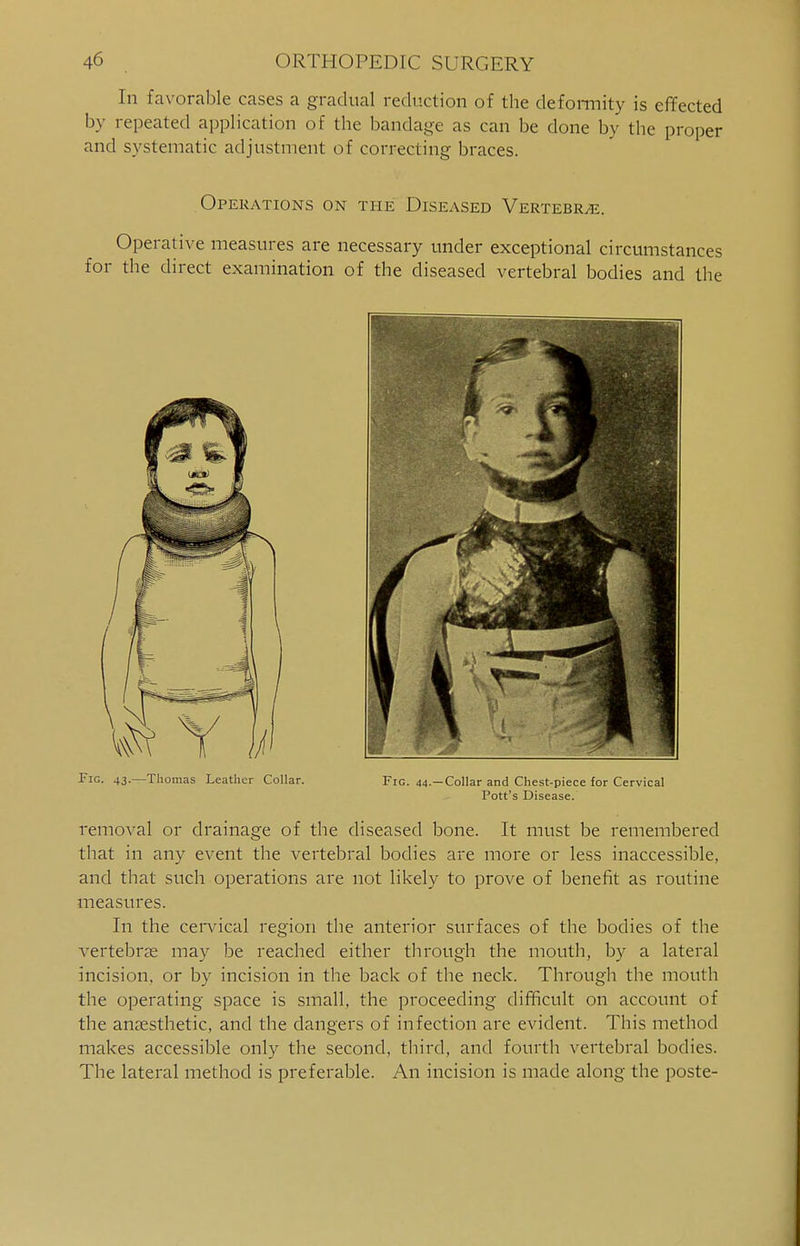 In favorable cases a gradual reduction of the deformity is effected by repeated application of the bandage as can be done by the proper and systematic adjustment of correcting braces. Operations on the Diseased Vertebr/e. Operative measures are necessary under exceptional circumstances for the direct examination of the diseased vertebral bodies and the Fig. 43.—Thomas Leather Collar. Fig. 44.—Collar and Chest-piece for Cervical Pott's Disease. removal or drainage of the diseased bone. It must be remembered that in any event the vertebral bodies are more or less inaccessible, and that such operations are not likely to prove of benefit as routine measures. In the cervical region the anterior surfaces of the bodies of the vertebrae may be reached either through the mouth, by a lateral incision, or by incision in the back of the neck. Through the mouth the operating space is small, the proceeding difficult on account of the anaesthetic, and the dangers of infection are evident. This method makes accessible only the second, third, and fourth vertebral bodies. The lateral method is preferable. An incision is made along the poste-