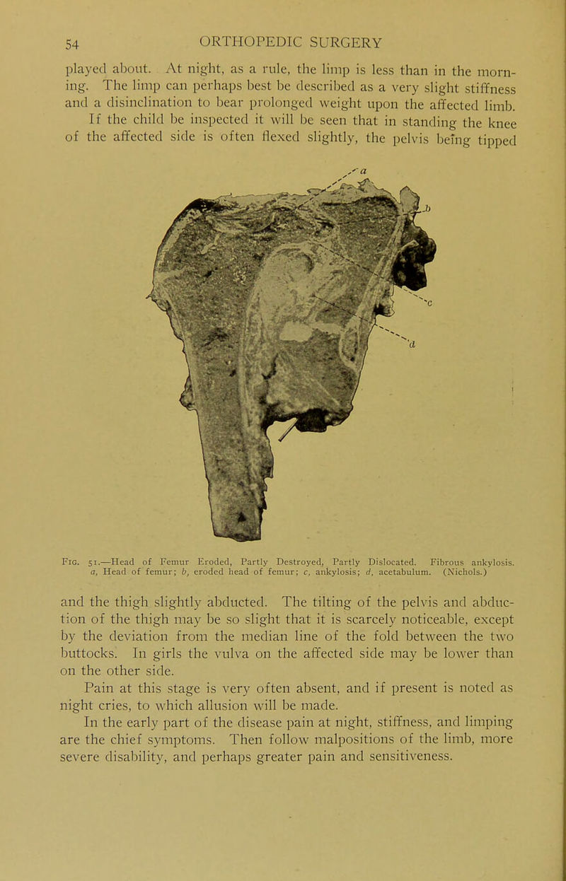 played about. At night, as a rule, the limp is less than in the morn- ing. The limp can perhaps best be described as a very slight stiffness and a disinclination to bear prolonged w eight upon the affected limb. If the child be inspected it will be seen that in standing the knee of the affected side is often flexed slightly, the pelvis being tipped Fig. 51.—Head of Femur Eroded, Partly Destroyed, Tartly Dislocated. Fibrous ankylosis. a, Head of femur; b, eroded head of femur; c, ankylosis; d, acetabulum. (Nichols.) and the thigh slightly abducted. The tilting of the pelvis and abduc- tion of the thigh may be so slight that it is scarcely noticeable, except by the deviation from the median line of the fold between the two buttocks. In girls the vulva on the affected side may be lower than on the other side. Pain at this stage is very often absent, and if present is noted as night cries, to which allusion will be made. In the early part of the disease pain at night, stiffness, and limping are the chief symptoms. Then follow malpositions of the limb, more severe disability, and perhaps greater pain and sensitiveness.