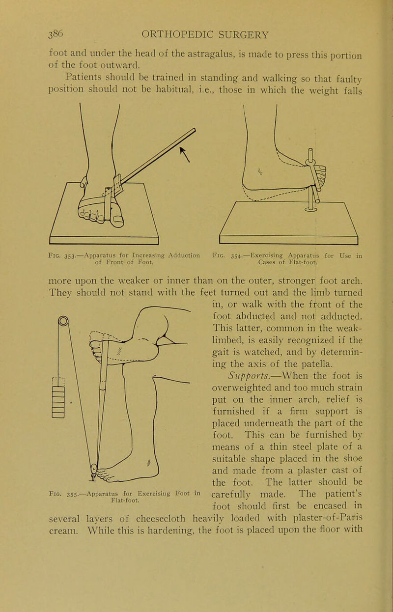 foot and under the head of the astragalus, is made to press this portion of the foot outward. Patients should be trained in standing and walking so that faulty position should not be habitual, i.e., those in which the weight falls Fig. 353.—Apparatus for Increasing Adduction of Front of Foot. Fig. 354.—Exercising Apparatus for Use in Cases of Flat-foot. more upon the weaker or inner than on the outer, stronger foot arch. They should not stand with the feet turned out and the limb turned in, or walk with the front of the foot abducted and not adducted. This latter, common in the weak- limbed, is easily recognized if the gait is watched, and by determin- ing the axis of the patella. Supports.—When the foot is overweighted and too much strain put on the inner arch, relief is furnished if a firm support is placed underneath the part of the foot. This can be furnished by means of a thin steel plate of a suitable shape placed in the shoe and made from a plaster cast of the foot. The latter should be carefully made. The patient's foot should first be encased in several layers of cheesecloth heavily loaded with plaster-of-Paris cream. While this is hardening, the foot is placed upon the floor with Fig. 355.—Apparatus for Exercising Foot Flat-foot.