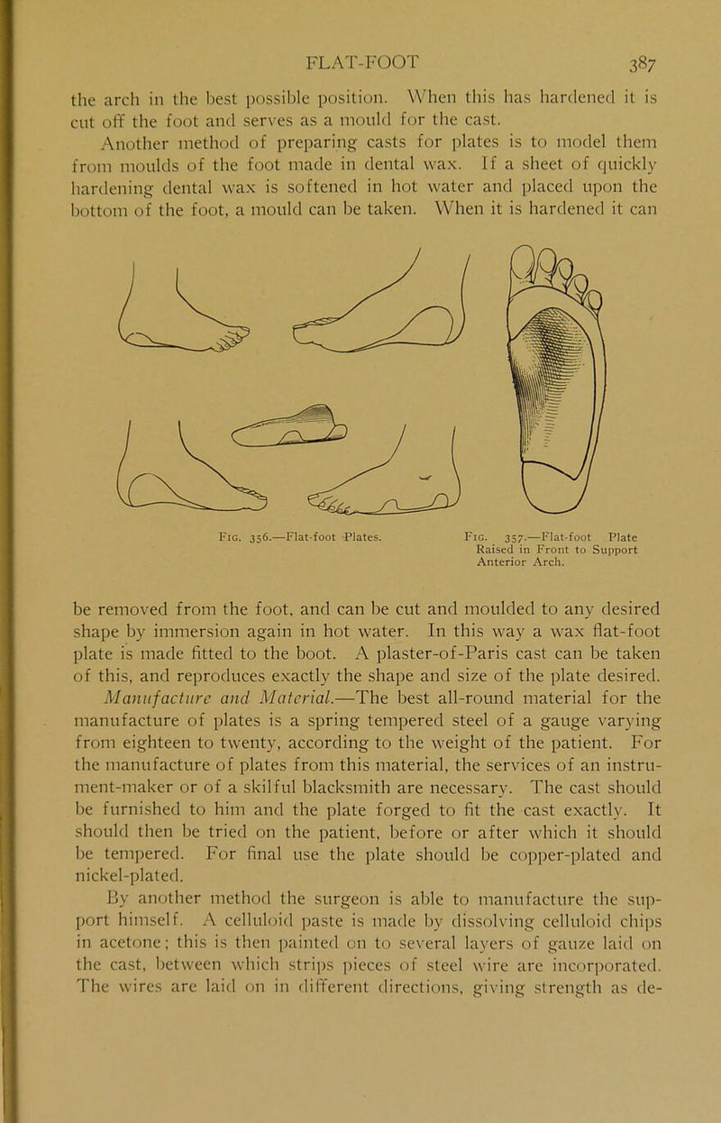 the arch in the best possible position. When this has hardened it is cut off the foot and serves as a mould for the cast. Another method of preparing casts for plates is to model them from moulds of the foot made in dental wax. [f a sheet of quickly hardening dental wax is softened in hot water and placed upon the bottom of the foot, a mould can be taken. When it is hardened it can Fig. 356.—Flat-foot Plates. Fig. 357.—Flat-foot Plate Raised in Front to Support Anterior Arch. be removed from the foot, and can be cut and moulded to any desired shape by immersion again in hot water. In this way a wax flat-foot plate is made fitted to the boot. A plaster-of-Paris cast can be taken of this, and reproduces exactly the shape and size of the plate desired. Manufacture and Material.—The best all-round material for the manufacture of plates is a spring tempered steel of a gauge varying from eighteen to twenty, according to the weight of the patient. For the manufacture of plates from this material, the services of an instru- ment-maker or of a skilful blacksmith are necessary. The cast should be furnished to him and the plate forged to fit the cast exactly. It should then be tried on the patient, before or after which it should be tempered. For final use the plate should be copper-plated and nickel-plated. By another method the surgeon is able to manufacture the sup- port himself. A celluloid paste is made by dissolving celluloid chips in acetone; this is then painted on to several layers of gauze laid on the cast, between which strips pieces of steel wire are incorporated. The wires are laid on in different directions, giving strength as de-