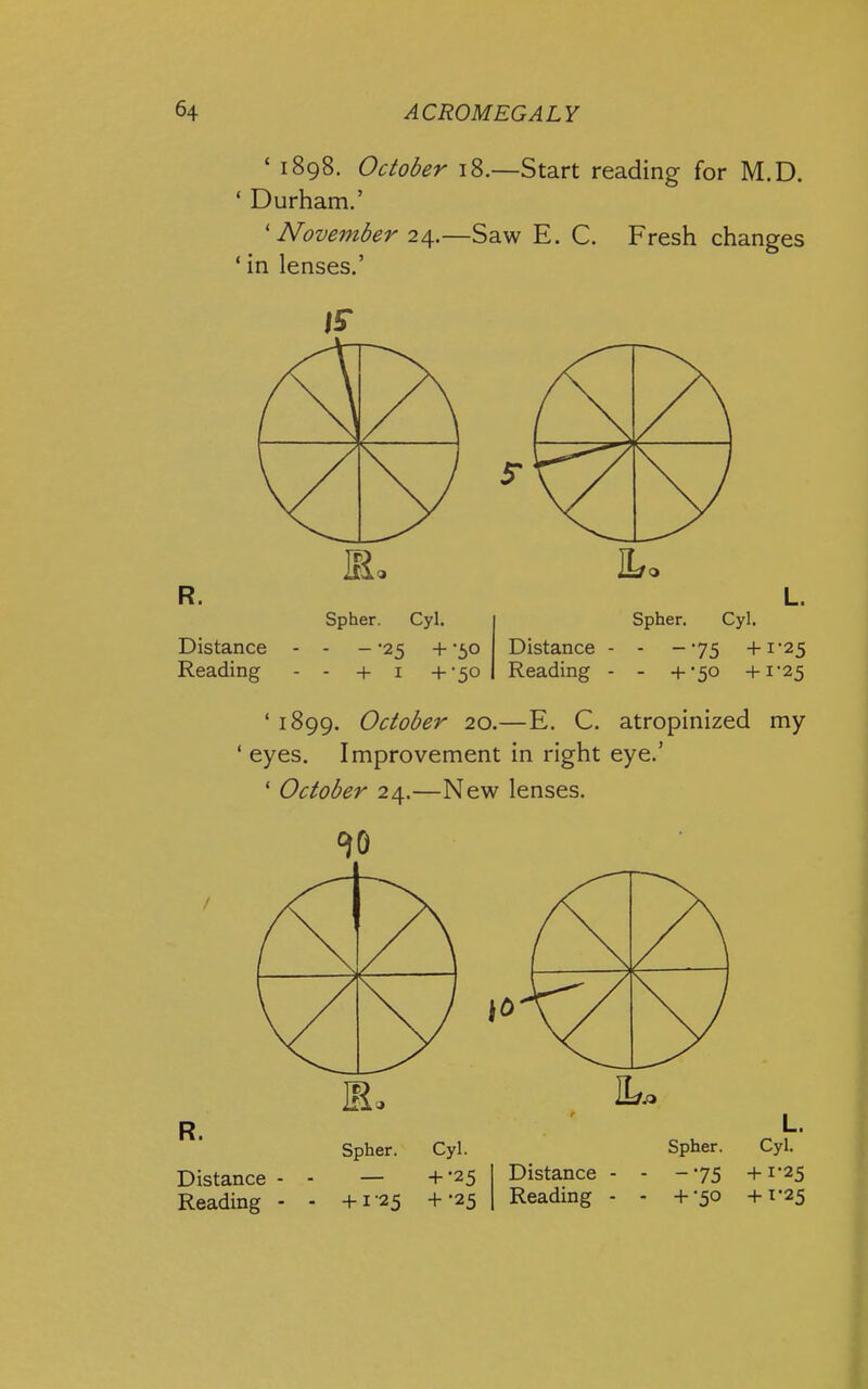 ' 1898. October 18.—Start reading for M.D. ' Durham.' ' November 2/[.—Saw E. C. Fresh changes ' in lenses.' R. Distance Reading Spher. Cyl. - - '25 + 50 - +1 +-30 Distance Reading Spher. Cyl. - -75 +1*25 - +-50 +1-25 ' 1899. October 20.—E. C. atropinized my ' eyes. Improvement in right eye.' ' October 24.—New lenses. R. Distance - Reading - Spher. Cyl. — +-25 + 1-25 +-25 Distance - Reading - L. Spher. Cyl. -75 +1-25 + •50 +1-25