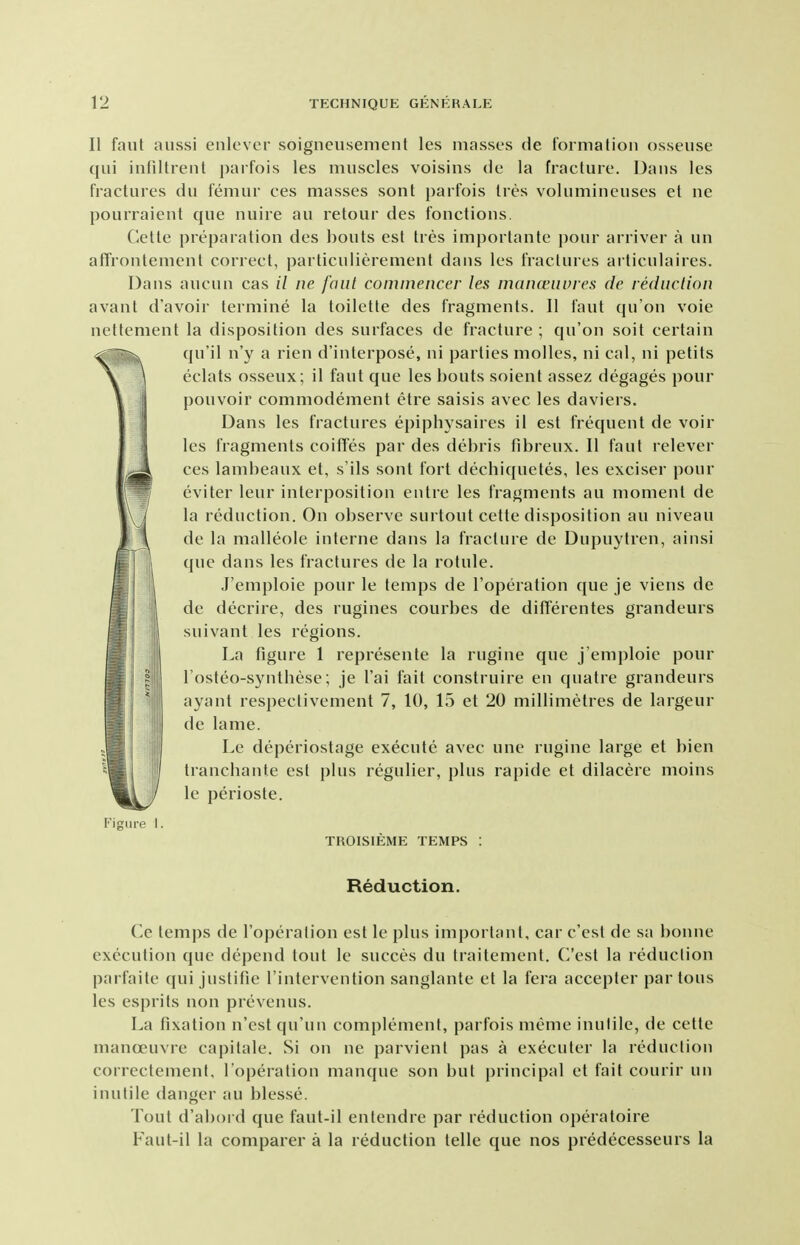 II faut aussi enlever soigneusement les masses de formation osseuse qui infiltrent parfois les muscles voisins de la fracture. Daus les fractures du femur ces masses sont i)arfois Ires volumineuses et ne pourraient que nuire au retour des fonctions. Cette preparation des bouts est tres importante pour arriver a un affrontement correct, particulierement dans les fractures articulaires. Dans aucun cas // ne font comineiicer les mananiures de rediiclion avant d'avoir termine la toilette des fragments. II faut qu'on voie nettenient la disposition des surfaces de fracture ; qu'on soil certain qu'il n'y a rien d'interpose, ni parties molles, ni cal, ni petits eclats osseux; il faut que les bouts soient assez degages pour pouvoir commodement etre saisis avec les daviers. Dans les fractures epiphysaires il est frequent de voir les fragments coifFes par des debris fibreux. II faut relever ces lambeaux et, s'ils sont fort dechiquetes, les exciser pour eviter leur interposition entre les fragments au moment de la reduction. On observe surtout cette disposition au niveau de la malleole interne dans la fracture de Dupuylren, ainsi que dans les fractures de la rotule. J'emploie pour le temps de I'operation que je viens de de decrire, des rugines courbes de ditTerentes grandeurs suivant les regions. La figure 1 represente la rugine que j'emploie pour I'osteo-syntbese; je I'ai fait construire en quatre grandeurs ayant respectivement 7, 10, 15 et 20 millimetres de largeur de lame. Le deperiostage execute avec une rugine large et bien trancbante est plus regulier, plus rapide et dilacere moins le perioste. Figure I. TROISIEME TEMPS : Reduction. Ce temps de I'operation est le plus important, car c'est de sa bonne execution que depend tout le succes du traitement. C'est la reduction parfaite qui justifie I'intervention sanglante et la fera accepter par tons les esprits non prevenus. La fixation n'est qu'un complement, parfois meme inutile, de cette manoeuvre capitate. Si on ne parvient pas a executer la reduction correctement, I'operation manque son but principal et fait courir un inutile danger au blesse. Tout d'abord que faut-il entendre par reduction operatoire Faut-il la comparer a la reduction telle que nos predecesseurs la