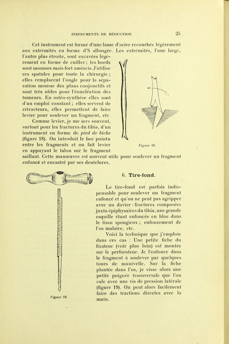Get instrument est fonne d'une lame d'acier recourbee legerement aiix extremites en forme d'S allong^e. Les extremites, Tune large, I'autre plus etroite, sont excavees lege- rement en forme de cuiller; les bords sont mousses mais fort amincis. J'utilise ces spatules pour toute la chirurgie ; elles reniplacent I'ongle pour la sepa- ration mousse des plans conjonctifs et sont tres utiles pour renucleation des tumeurs. En osteo-synthese elles sont d'un emploi constant; elles servent de retracteurs, elles permettent de faire levier pour soulever un fragment, etc. Comma levier, je me sers souvent, surtout pour les fractures du tibia, d'un instrument en forme de pied de biche (figure 18). On introduit le bee pointu entre les fragments et on fait levier en appuyant le talon sur le fragment saillant. Cette manoeuvre est souvent utile pour soulever un fragment enfonce et encastre par ses dentelures. Fiuie 18. Figure 19. 6. Tire-fond. Le tire-fond est parfois indis- pensable pour soulever un fragment enfonce et qu'on ne pent pas agripper avec un davier : fractures composees juxta-epiphysaires du tibia, une grande esquille etant enfoncee en bloc dans le tissu spongieux ; enfoncement de I'os malaire, etc. Voici la tecbnique que j'emploie dans ces cas : Une petite fiche du fixateur (voir plus loin) est montee sur le perforateur. Je I'enfonce dans le fragment a soulever par quelques tours de manivelle. Sur la fiche plantee dans I'os, je visse alors une petite poignee transversale que Ton cale avec une vis de pression laterale (figure 19). On pent alors facilement faire des tractions directes avec la main.