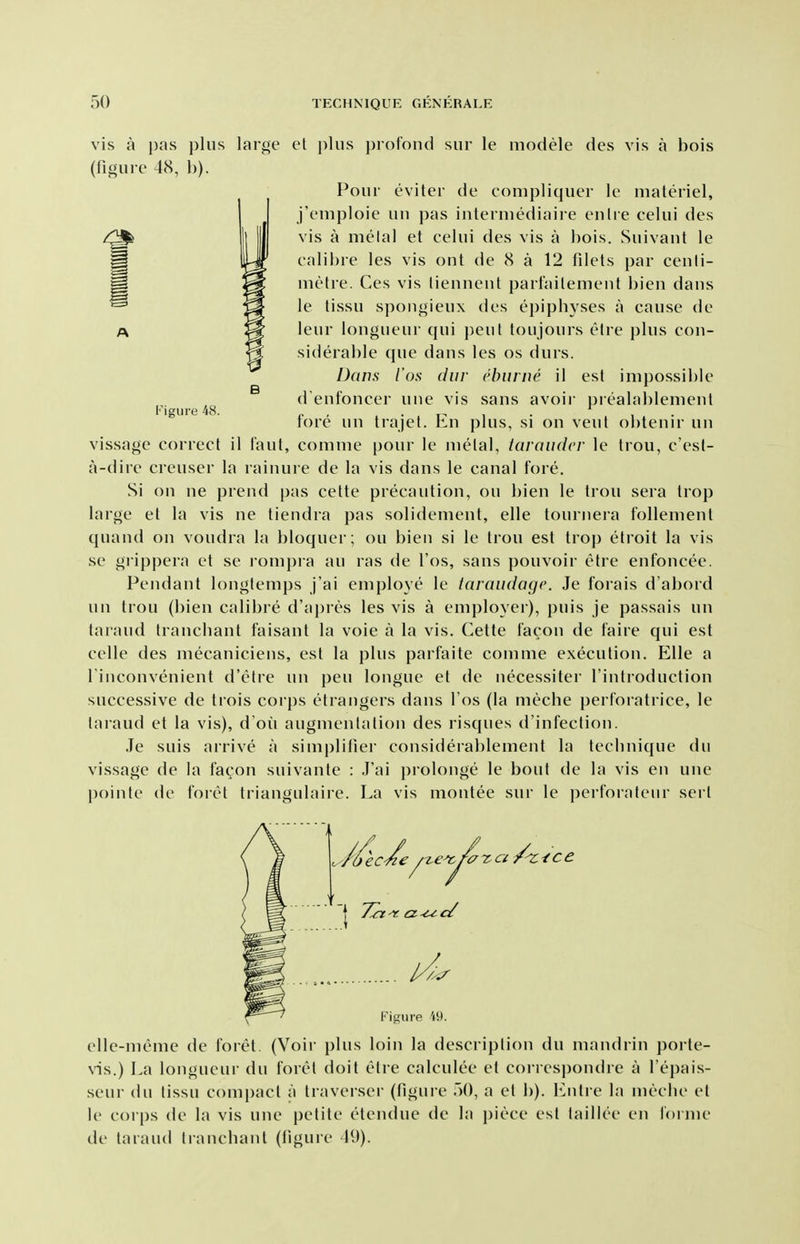 Figure 48. vis a pas plus large et i)]us profond siir le modele des vis a bois (figure 48, b). Pour eviler de eonipliquer le materiel, j'eniploie uu pas interniediaire enlre celui des vis a melal et eelui des vis a bois. Suivant le calibre les vis out de 8 a 12 filets par ceuti- metre. Ces vis liennent parfailement bien daus le tissu spongieux des epiphyses a cause de leur lougueur qui peut foujours elre plus con- siderable que daus les os durs. Dans I'os diir ebiirne il est impossible d enfoncer uue vis sans avoir prealablemeut fore un trajet. En plus, si on veut obteuir un vissage correct il I'aut, comnie pour le metal, tavaudcv le trou, c'est- ji-dire creuser la rainure de la vis dans le canal fore. Si on ne prend pas cette precaution, ou bien le trou sera Irop large et la vis ne tiendra pas solidement, elle tournera follement quand on voudra la bloquer; ou bien si le trou est trop etroit la vis se grippera et se rompra au ras de I'os, sans pouvoir elre enfoncee. Pendant longlemps j'ai employe le taraudage. Je forais d'abord un trou (bien calibre d'apres les vis a employer), puis je passais un taraud trancliant faisant la voie a la vis. Cette facon de faire qui est celle des mecaniciens, est la plus parfaite comme execution. Elle a l inconvenient d'etre un pen longue et de necessiter I'introduction successive de trois corps etrangers dans I'os (la meche perforatrice, le taraud et la vis), d'ou augmentation des risques d'infection. Je suis arrive a simplifier considerablement la technique du vissage de la facon suivante : J'ai prolonge le bout de la vis en une poinle de foiet triangulaire. La vis montee sur le ])erforaleiir sert Figure 49. elle-meme de foret. (Voir plus loin la description du mandrin porte- vis.) La longueur du foret doit etre calculee et corres|)ondre a I'epais- seur du tissu compact a traverser (figure .lO, a et b). b>nti e la meche et le corps de la vis une petite etendue de la piece est taillee en lorme de taraud Irancbant (figure 19).