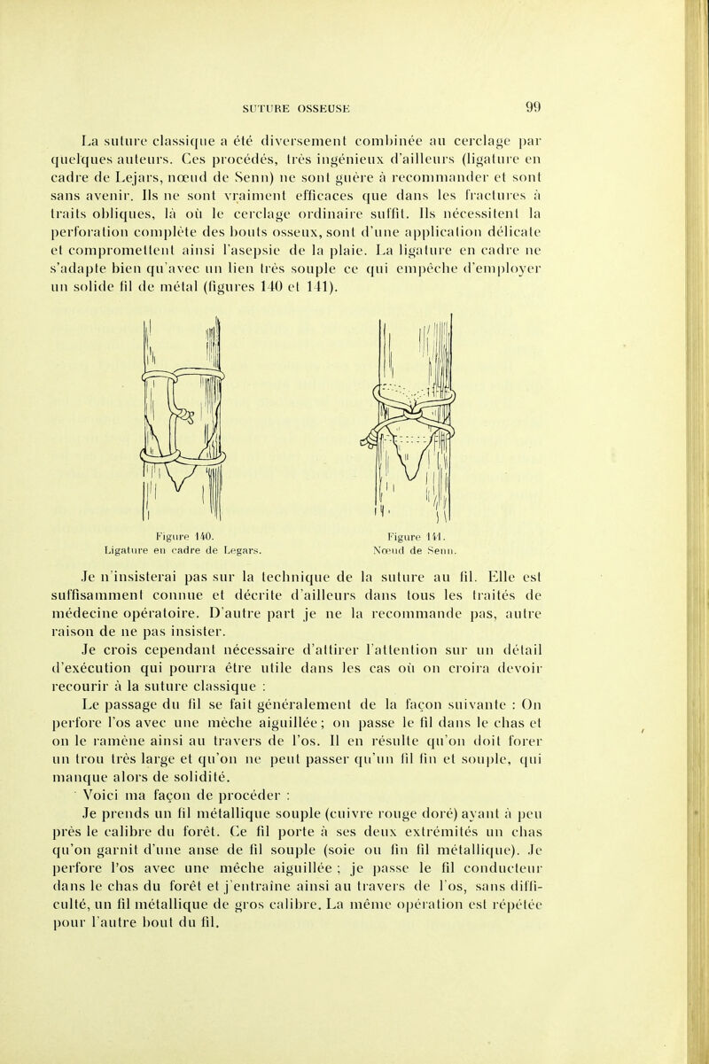 La suture classique a ete divcrsement coml)inee au cerclage ])ar quelques auteiirs. Ces procedes, Ires iiigenieux d'aillcurs (ligature en cadre de Lejars, noeud de Senn) iie sont guere a reconiniander et sont sans avenir. lis ne sont vraiment efficaces que dans les fractures a traits obliques, la ou le cerclage ordinaiie suffit. lis necessitenl la perforation complete des bouts osseux, sont d'uue application delicate et compromettenl ainsi rasej)sie de la plaie. La ligature en cadre ne s'adapte bien qu'avec un lien tres souple ce qui enipecbe d'eniployer un solide fil de metal (figui es 140 el 141). Je n'insisterai pas sur la tecbnique de la suture au til. Elle est suffisamment connue et decrite d'aillcurs dans tons les tiaites de niedecine operatoire. D'autre part je ne la recommande pas, autre raison de ne pas insister. Je crois cependant necessaire d'attirer I'attention sur un detail d'execution qui pouria etre utile dans les cas ou on croira devoir recourir a la suture classique : Le passage du fil se fait generalement de la facon suivante : On perfore I'os avec une meche aiguillee; on passe le fd dans le cbas el on le ramene ainsi au travers de I'os. 11 en resulte qu'on doit forer un trou tres large et qu'on ne pent passer qu'un til tin et souple, qui manque alors de solidite,  Voici ma facon de proceder : Je prends un fil metallique souple (cuivre rouge dore)ayant a pen pres le calibre du foret. Ce fd porte a ses deux extremites un cbas qu'on garuit d'une anse de til souple (sole ou flu fd metallique). Je perfore I'os avec une mecbe aiguillee ; je jjasse le fd conducleui- dans le cbas du foret et j'entraine ainsi au travers de I'os, sans difti- culte, un fil metallique de gros calibre. La meme operation est repetee pour I'autre bout du fd. Figure 140. Ligature en cadre de Legars. Figure 1 il. NfFud de SenII.